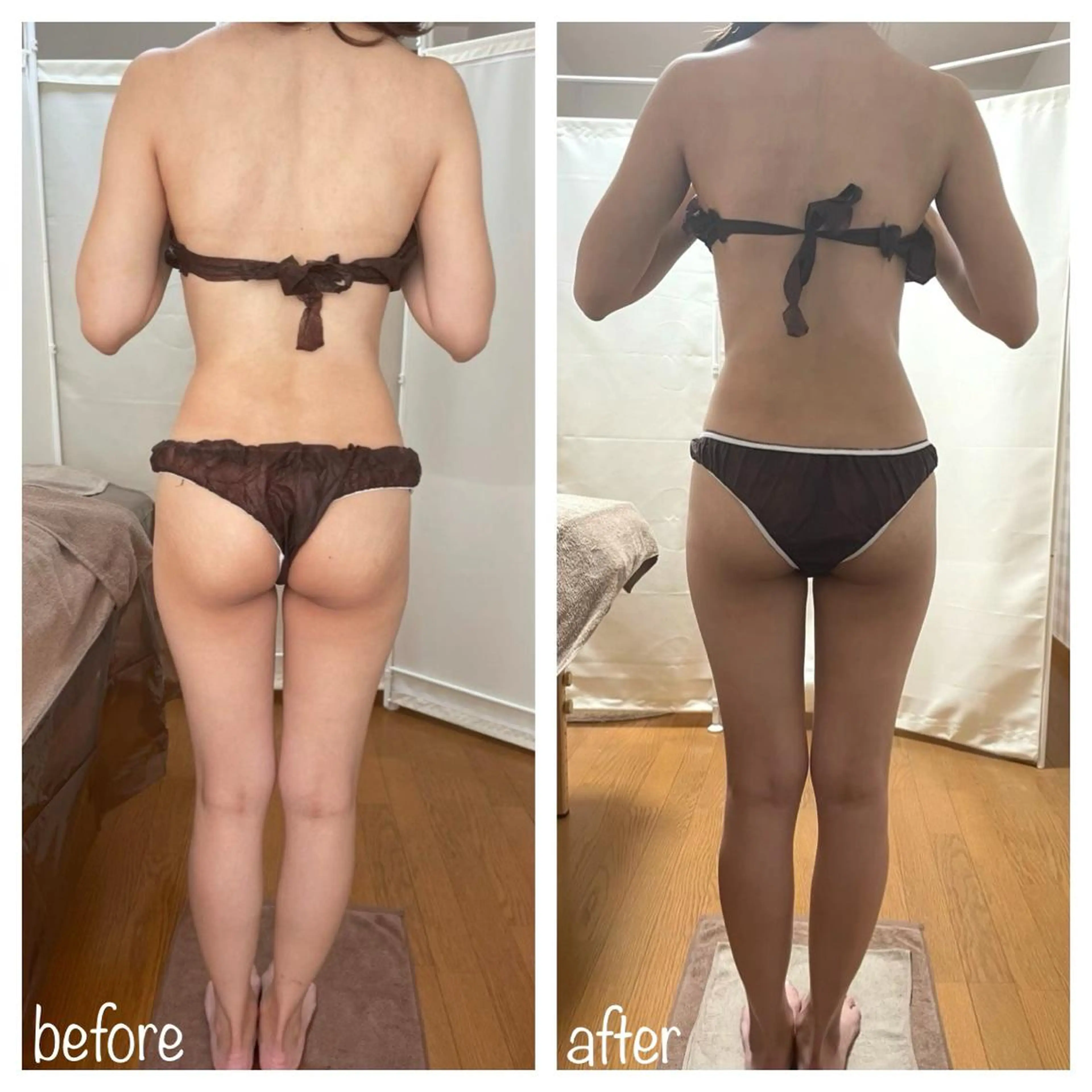 《本気痩せ×疲労改善 》  BILOOPのエステ・リラクイメージ