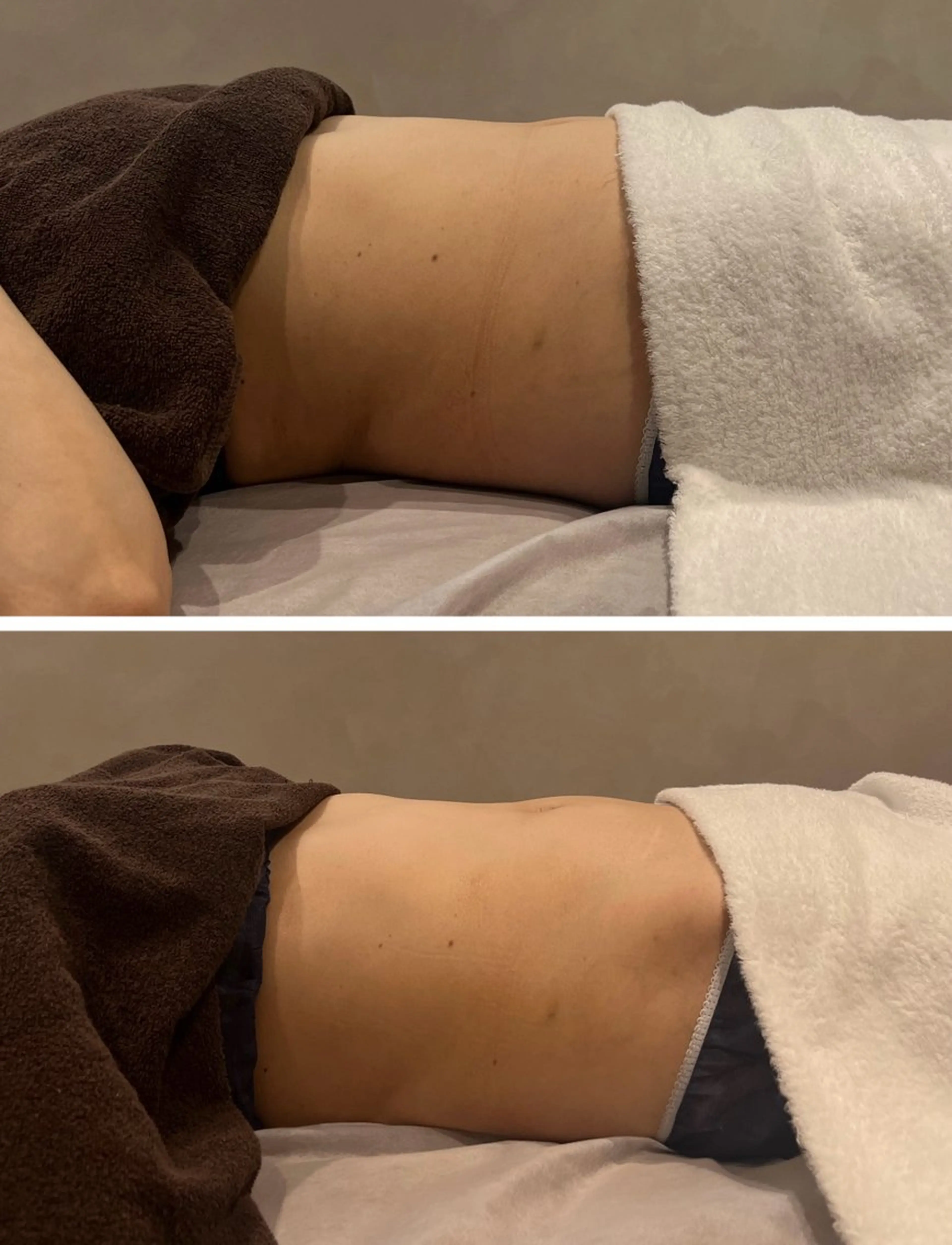 エステ 【毛穴&腸もみ】 salon kiwaのエステ・リラクイメージ