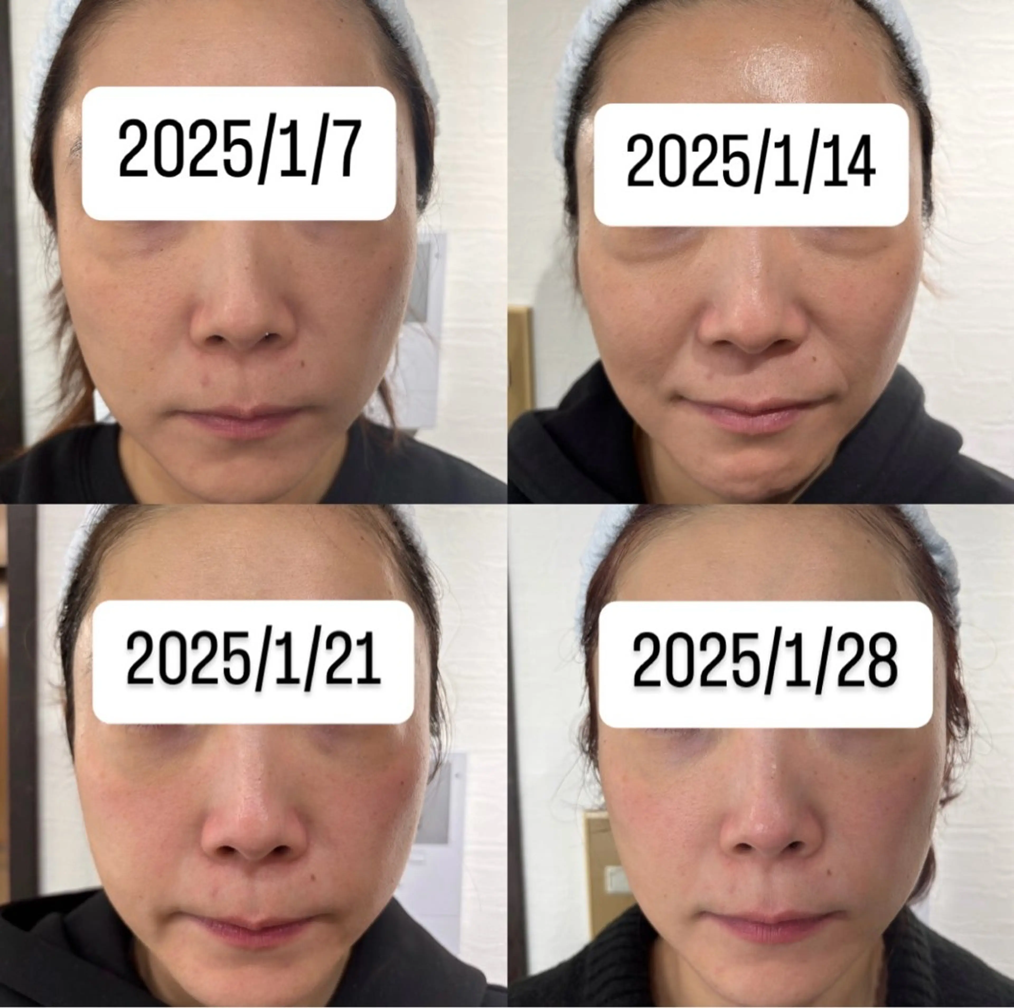 エステ ✨ナリス化粧品✨ Shinyのエステ・リラクイメージ