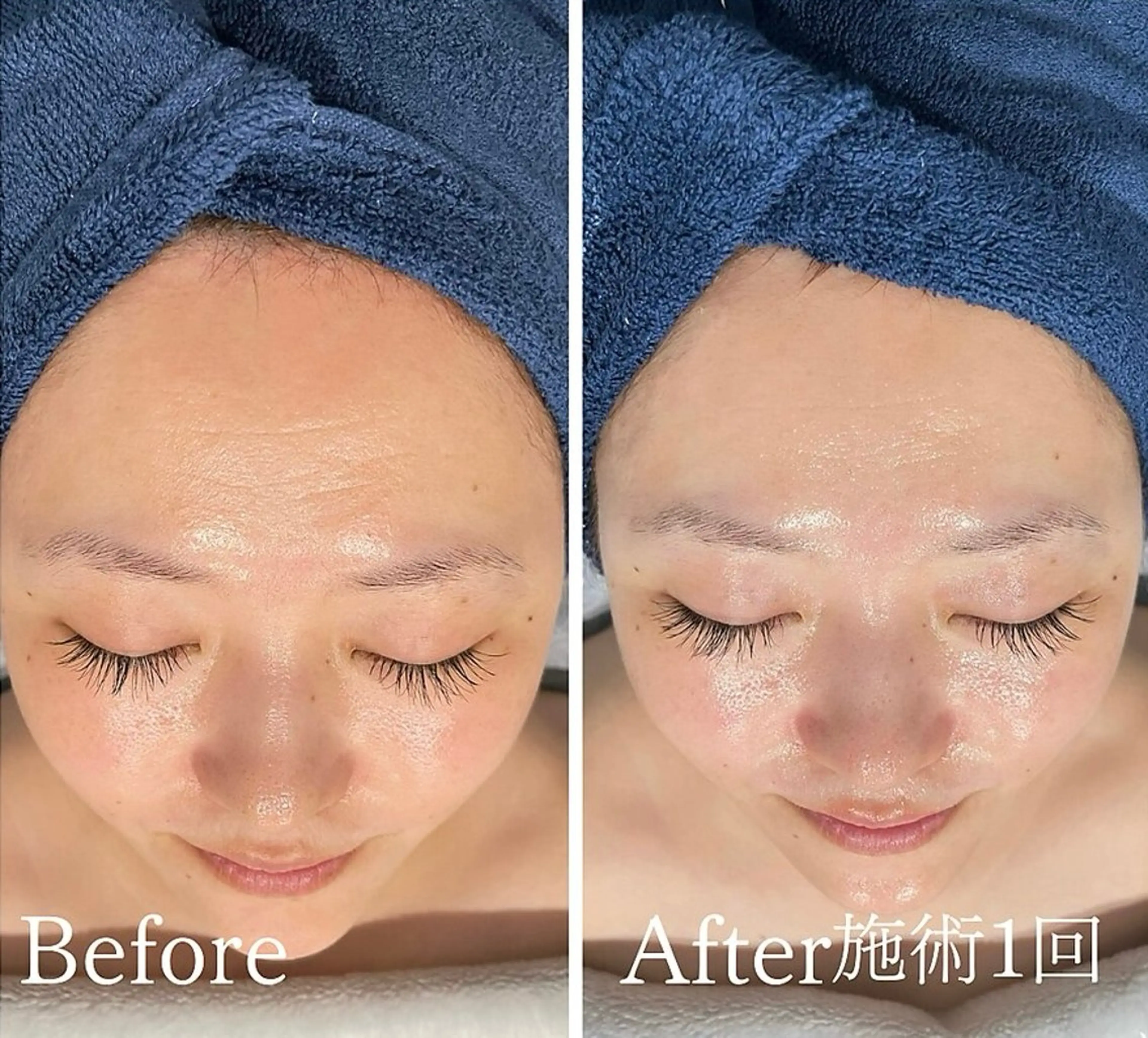 アンド ミルルのエステ・リラクイメージ