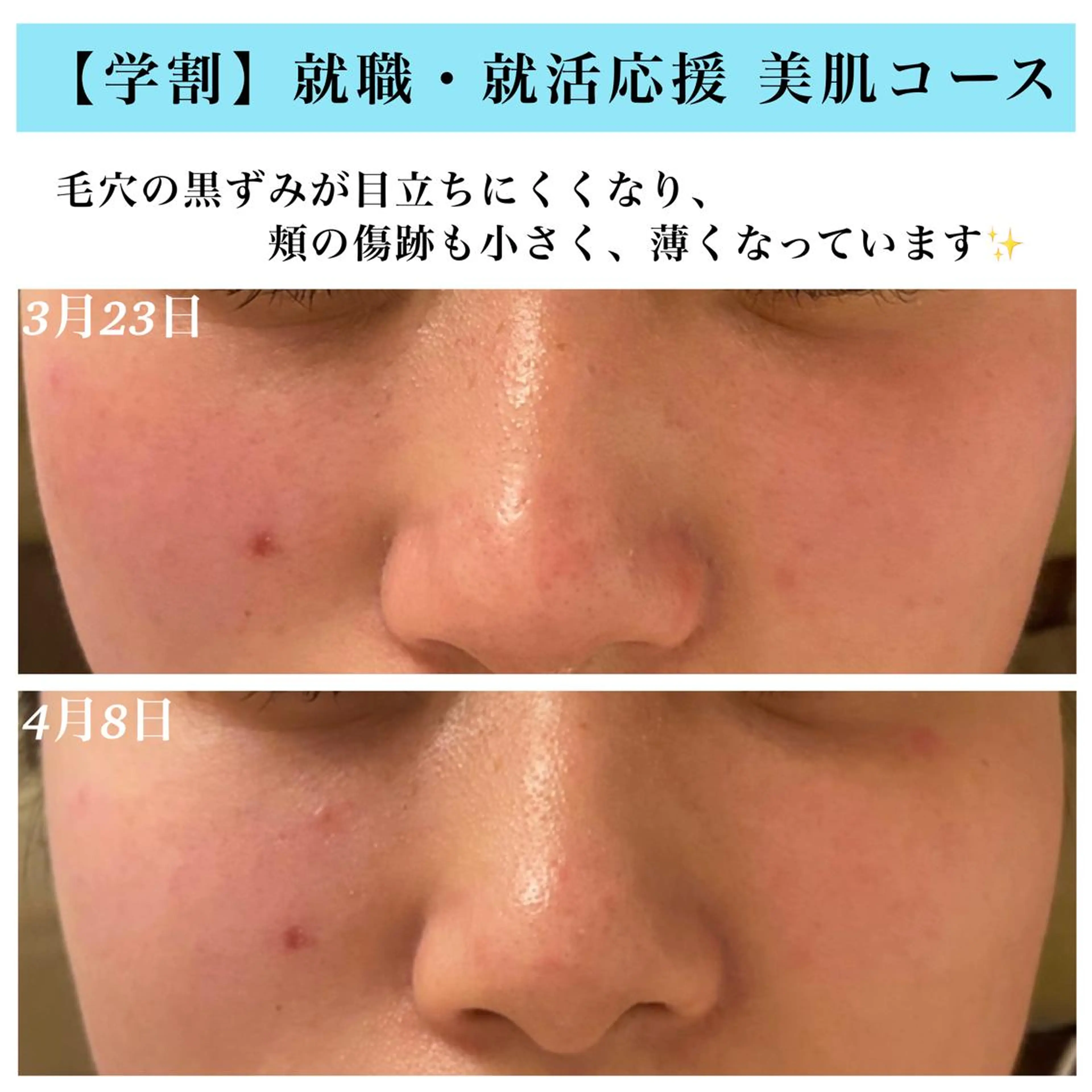 エステ Bellesthe （ベルエステ）のエステ・リラクイメージ