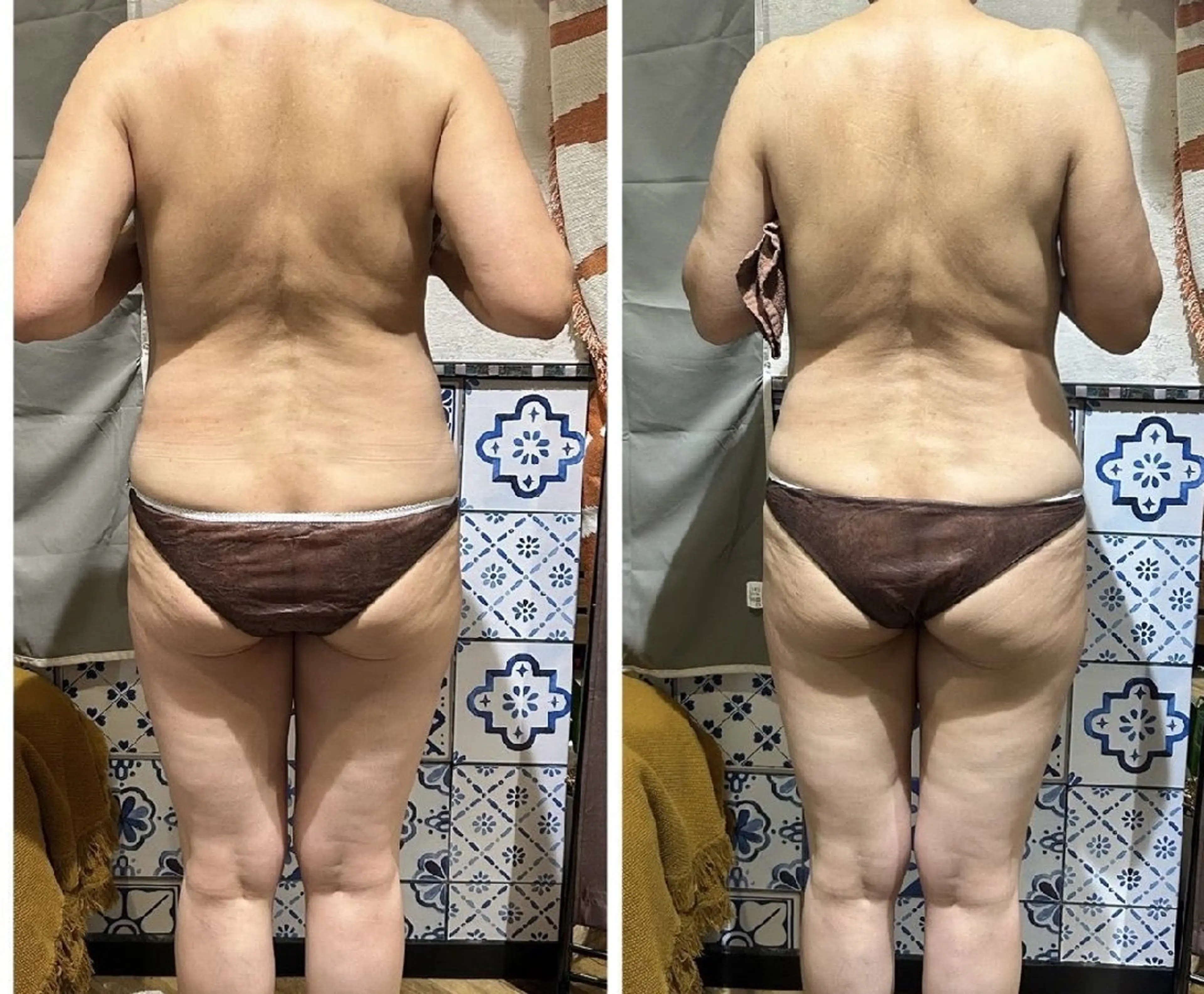 ARUHI asuのその他イメージ