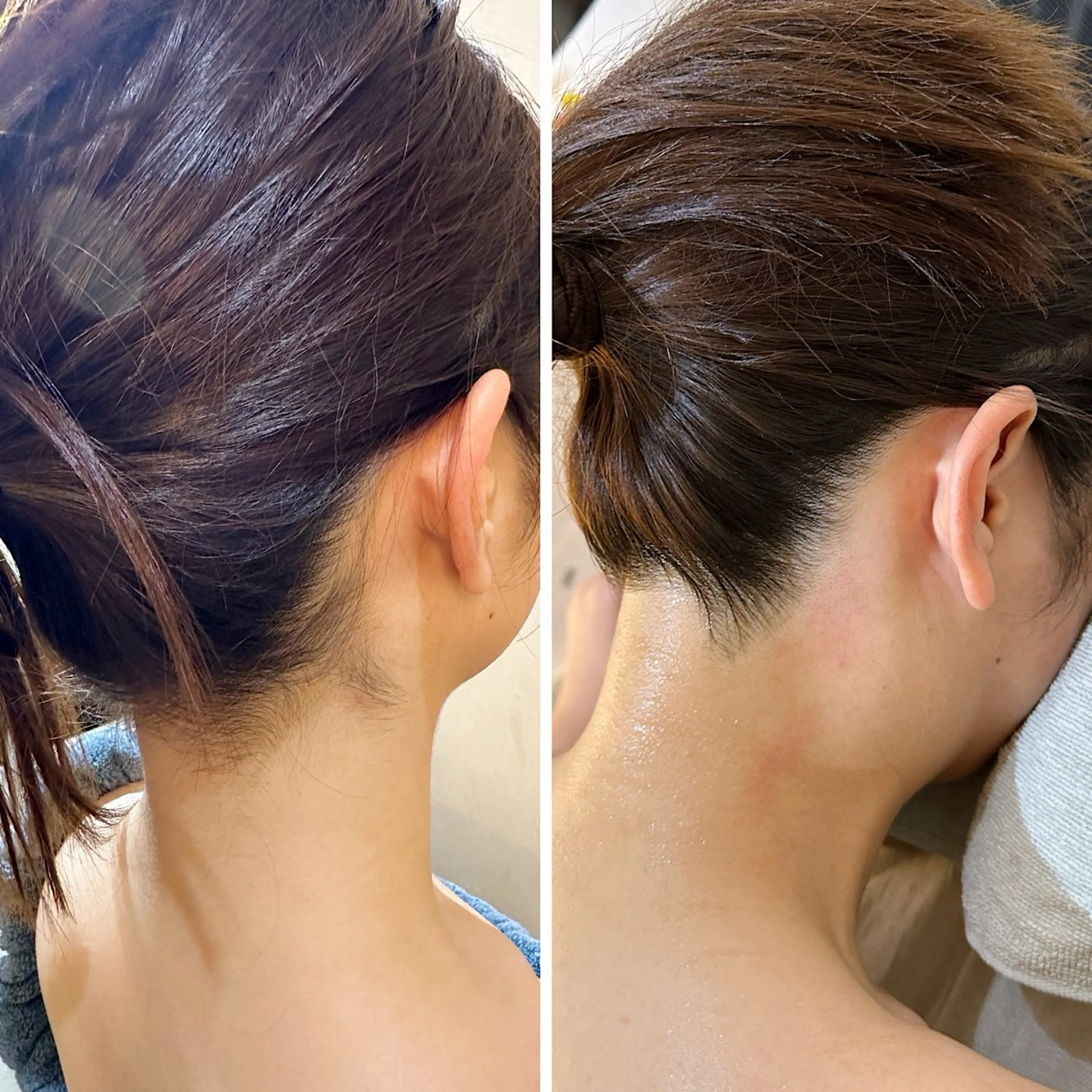 脱毛 うなじ脱毛/美肌脱毛 LABELのエステ・リラクイメージ