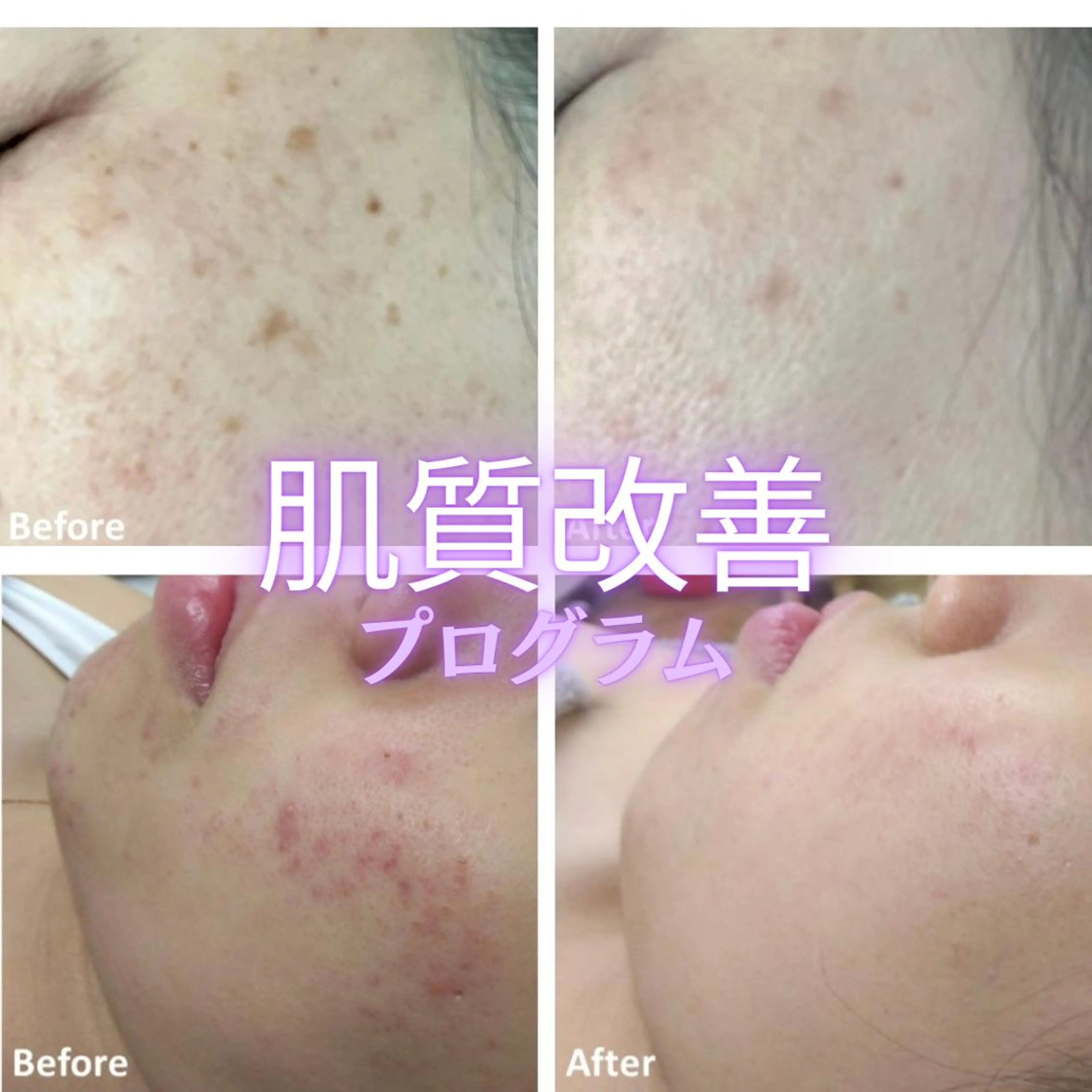 Adam 上半身美人のエステ・リラクイメージ