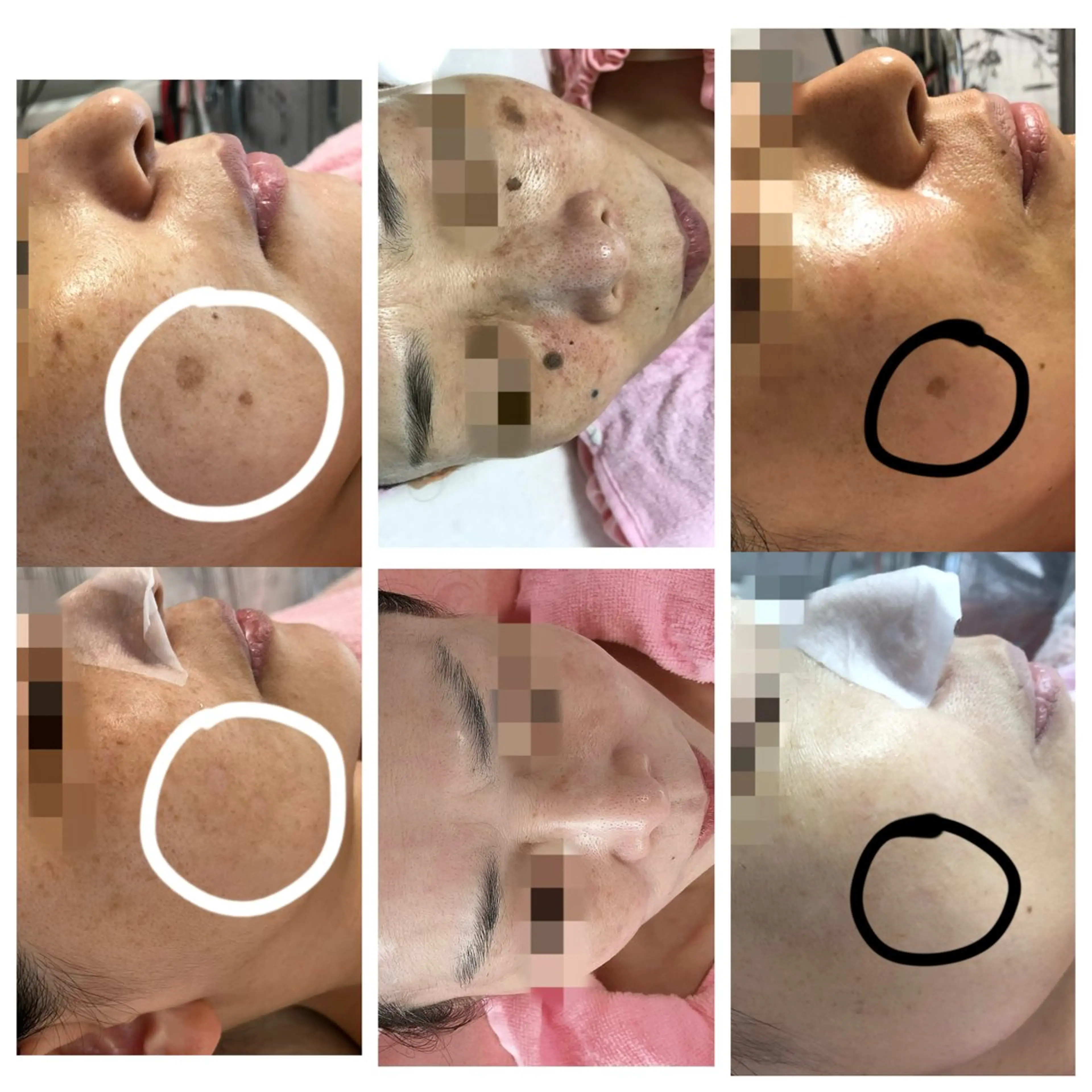 顔専門エステ プリエールビューティのエステ・リラクイメージ