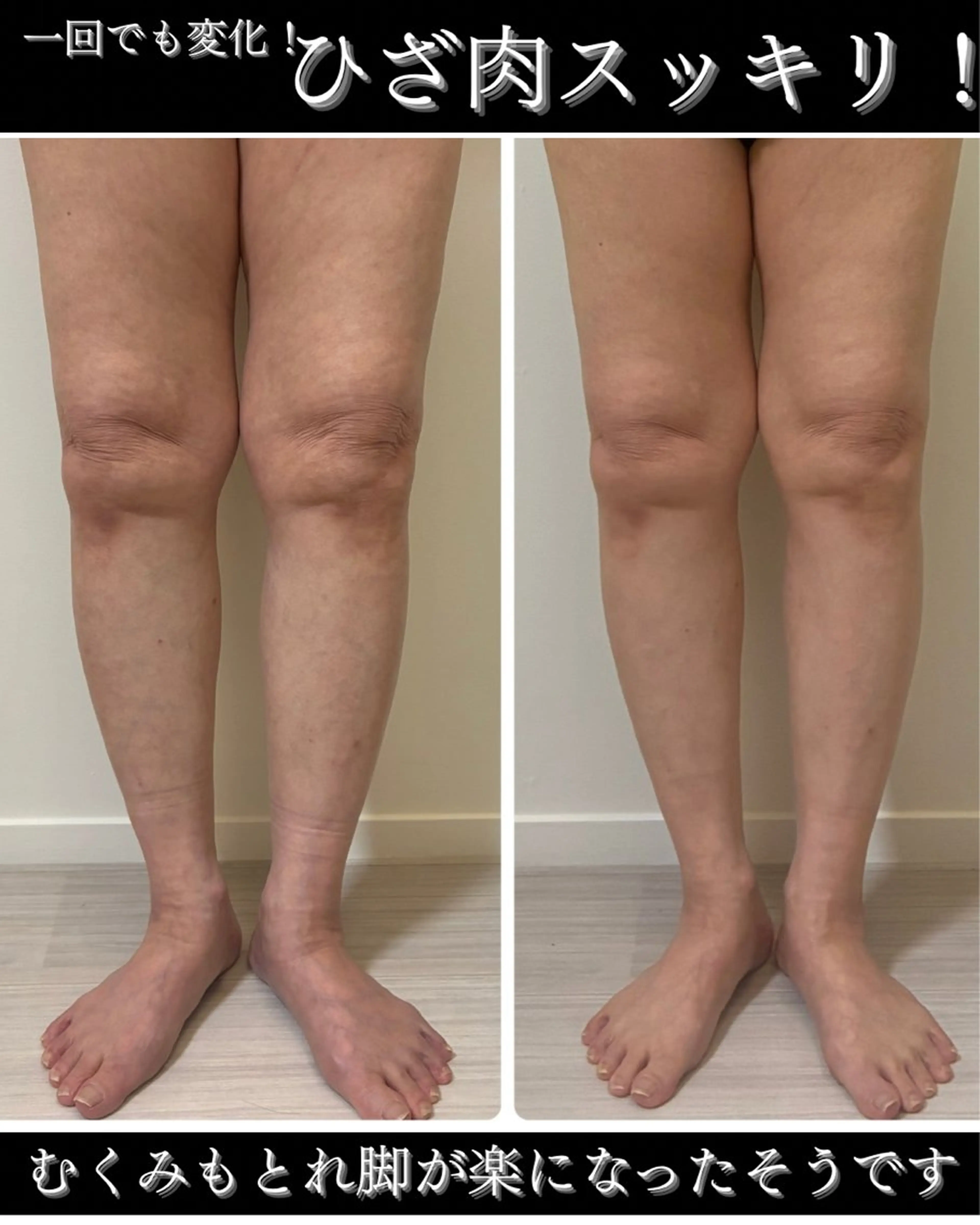 デトックス×ボディメンテナンスサロンShikhara（シカラ）所属・オールハンド筋膜痩身 整体/小顔　中山朝美のエステ・リラクイメージ