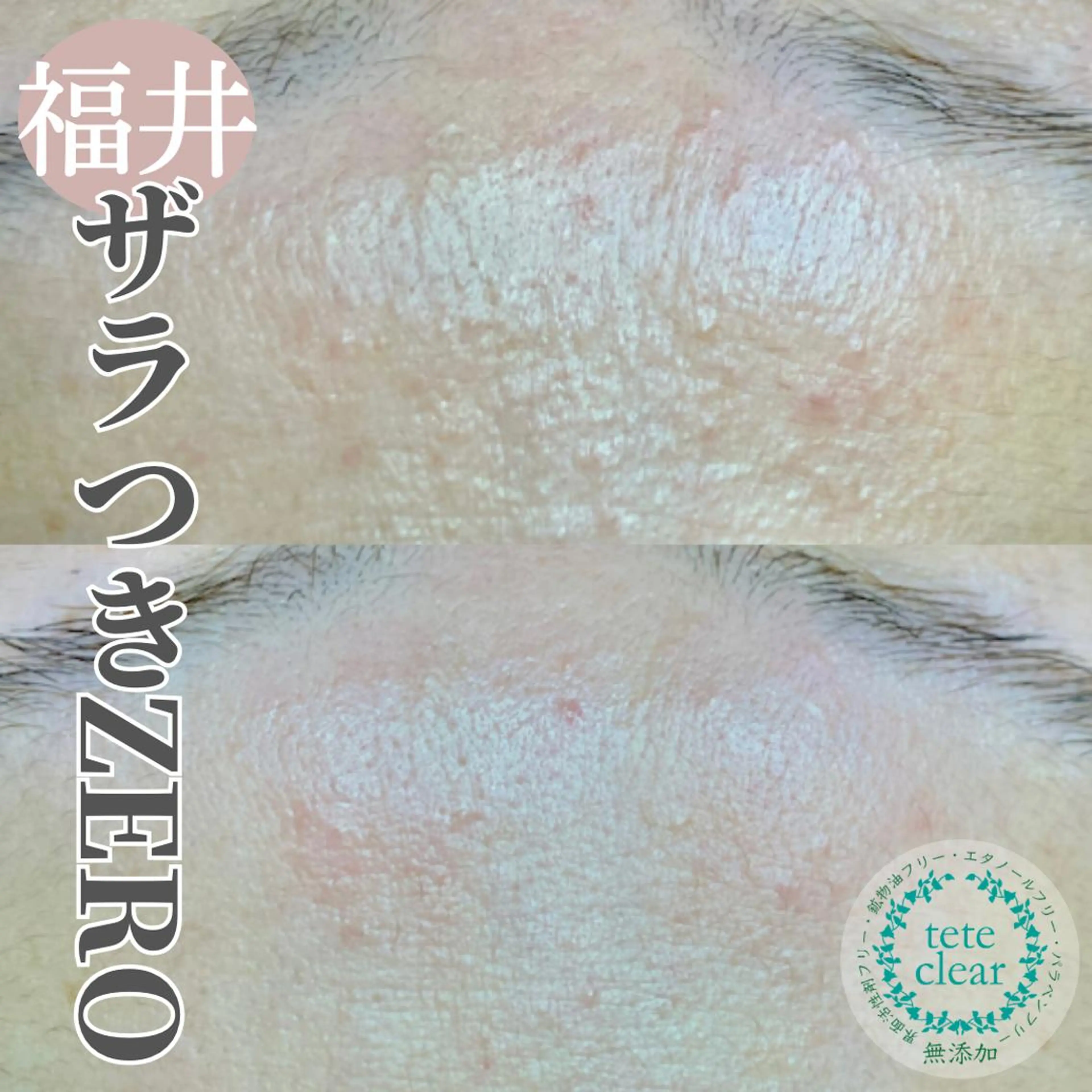 毛穴肌質ケアサロン Yourmeユアミーのエステ・リラクイメージ