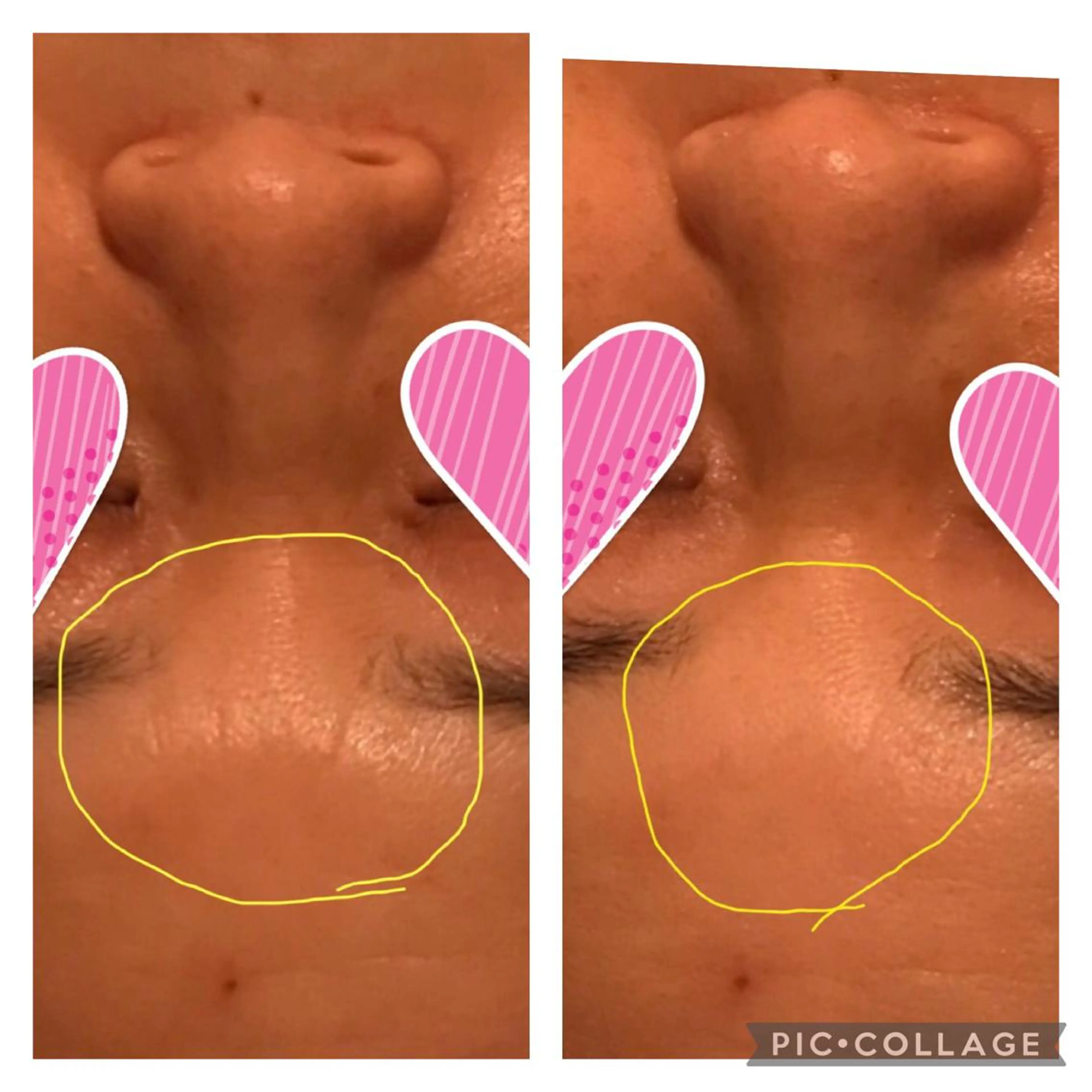 POLA 大阪堀江店のエステ・リラクイメージ