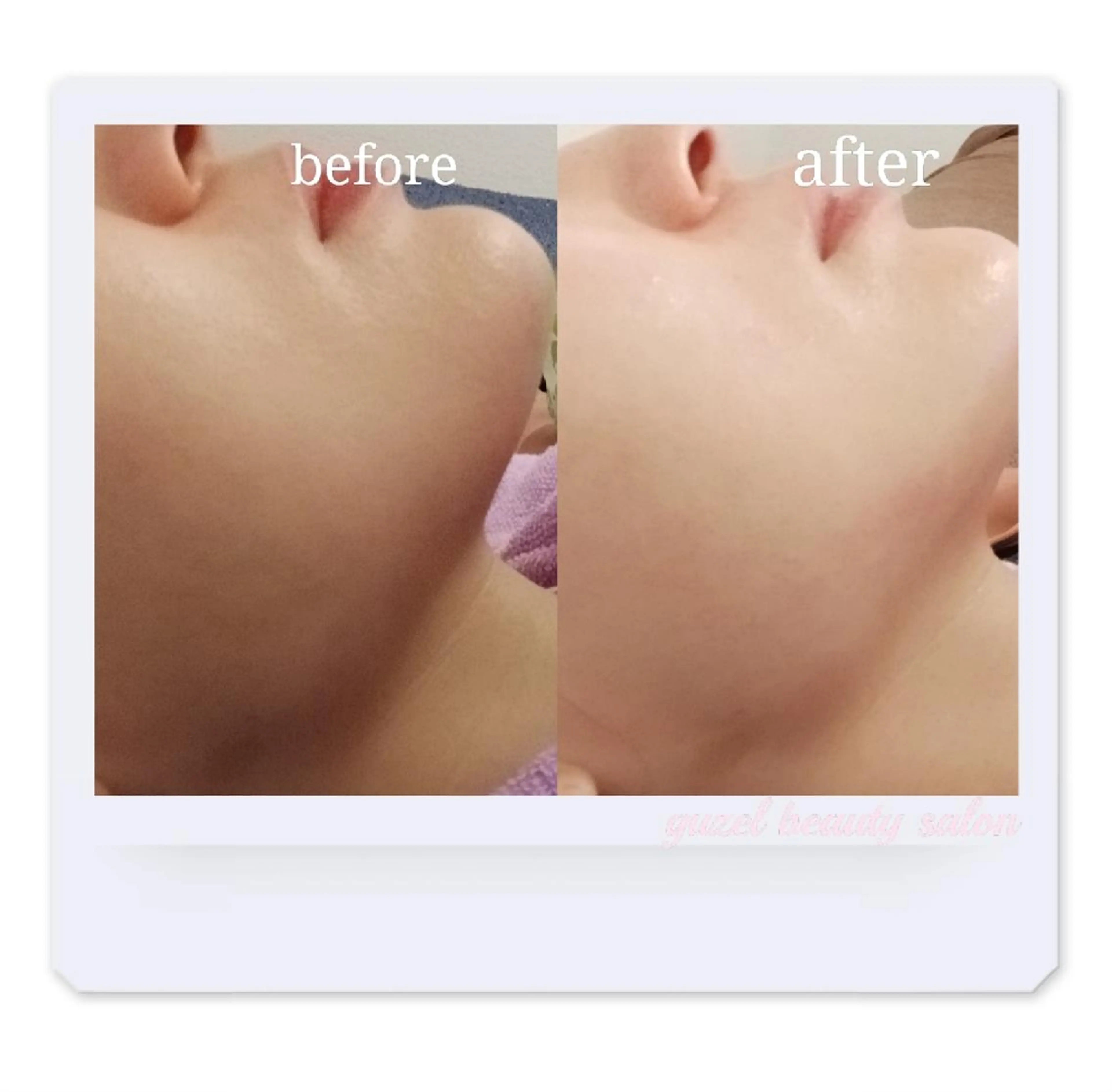 エステ 🅖🅤🅩🅔🅛 salonのエステ・リラクイメージ