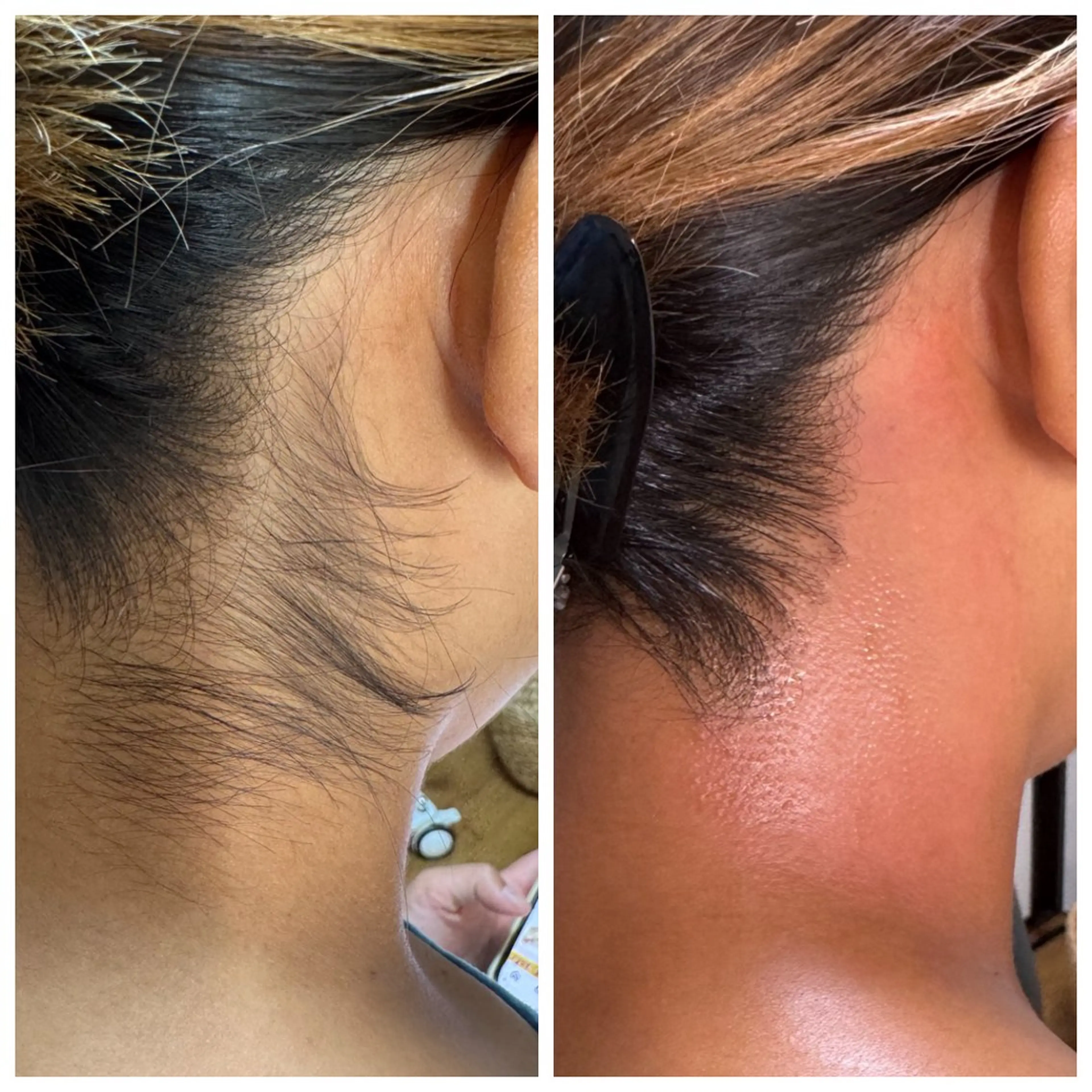 脱毛 Tiidaguu ‪🔆‬緒方愛美のエステ・リラクイメージ