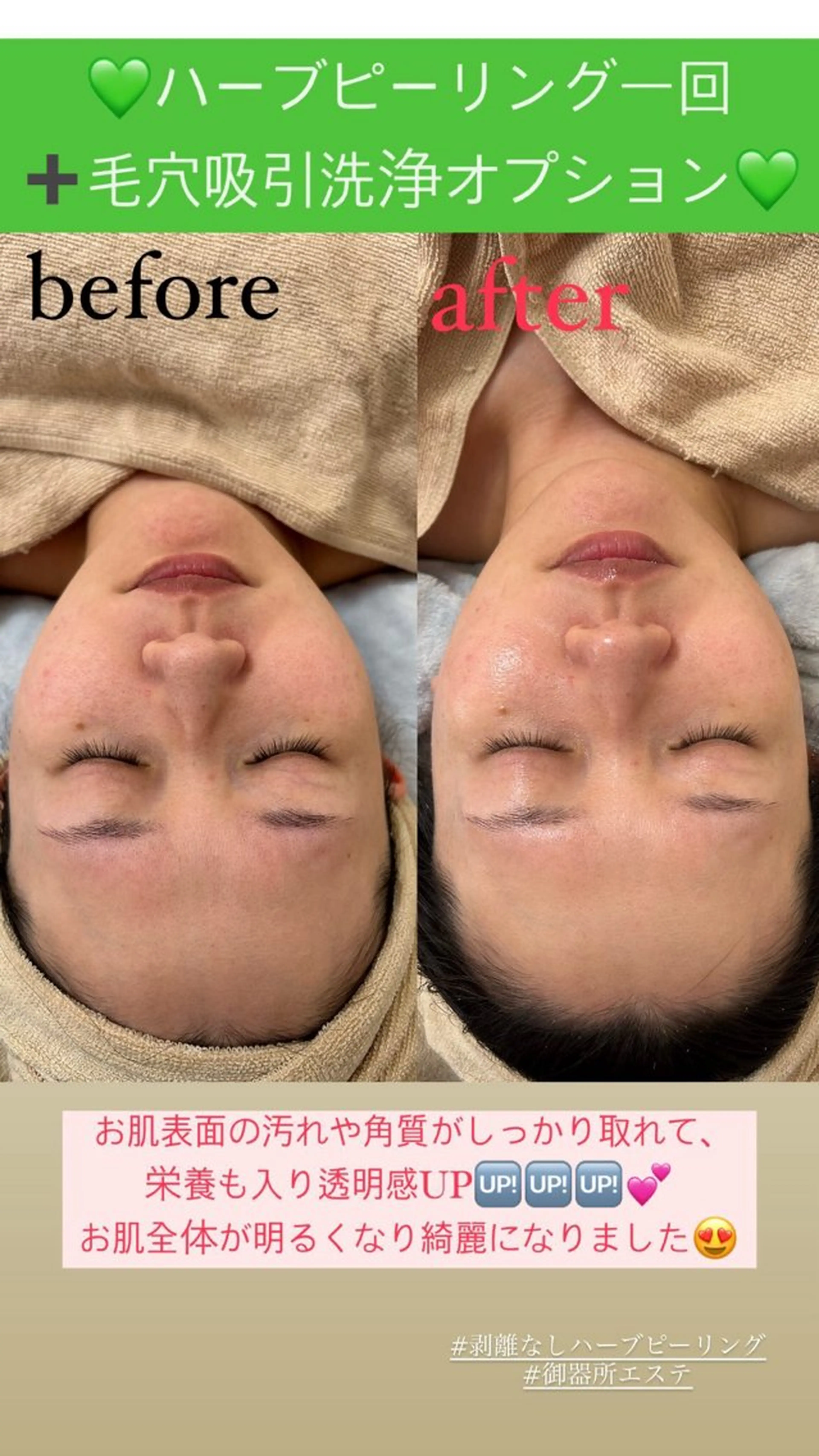 メンズ エステ Salon de Lino 御器所のエステ・リラクイメージ