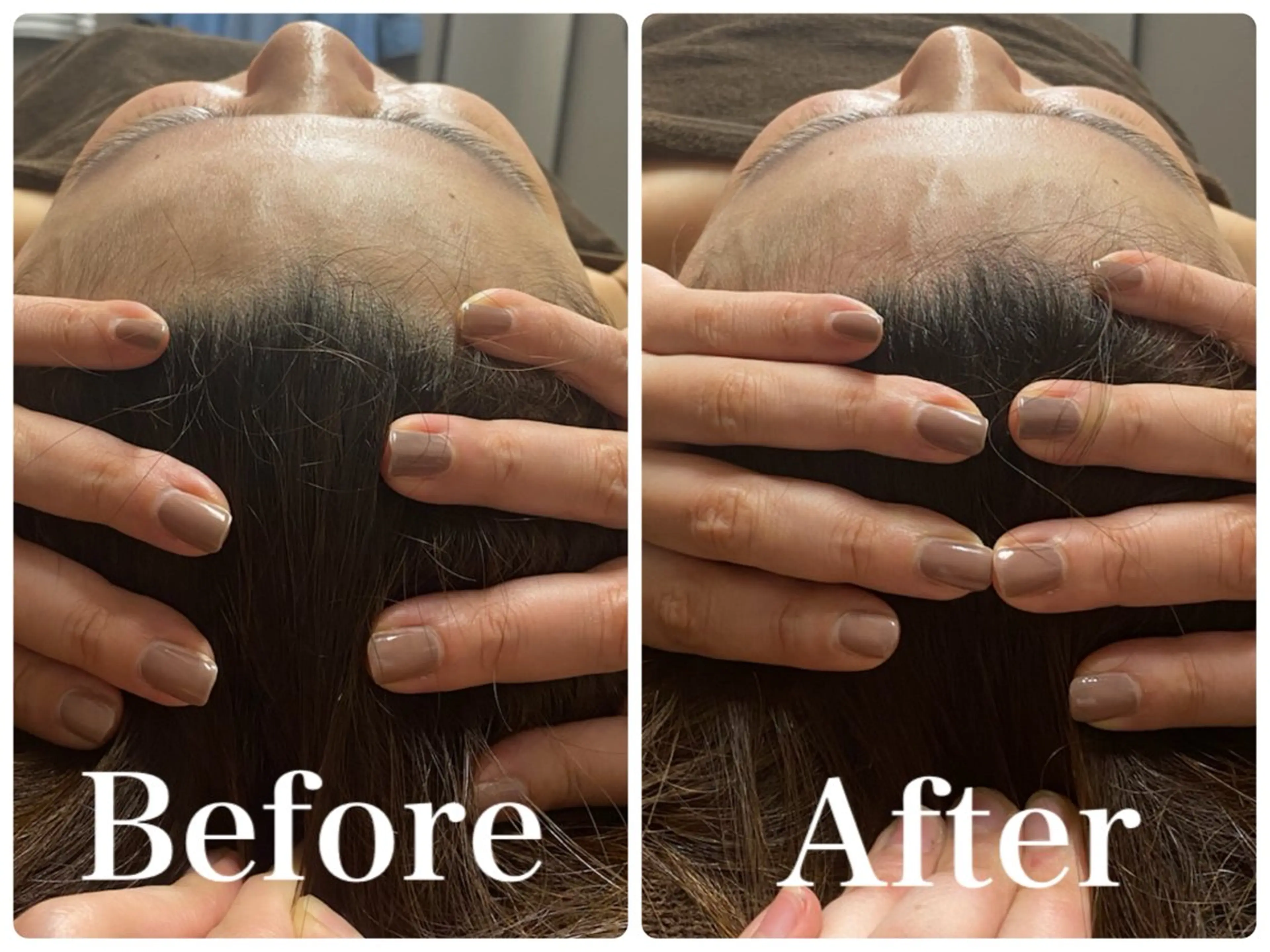 💎小顔サロン アリリン銀座💎のエステ・リラクイメージ