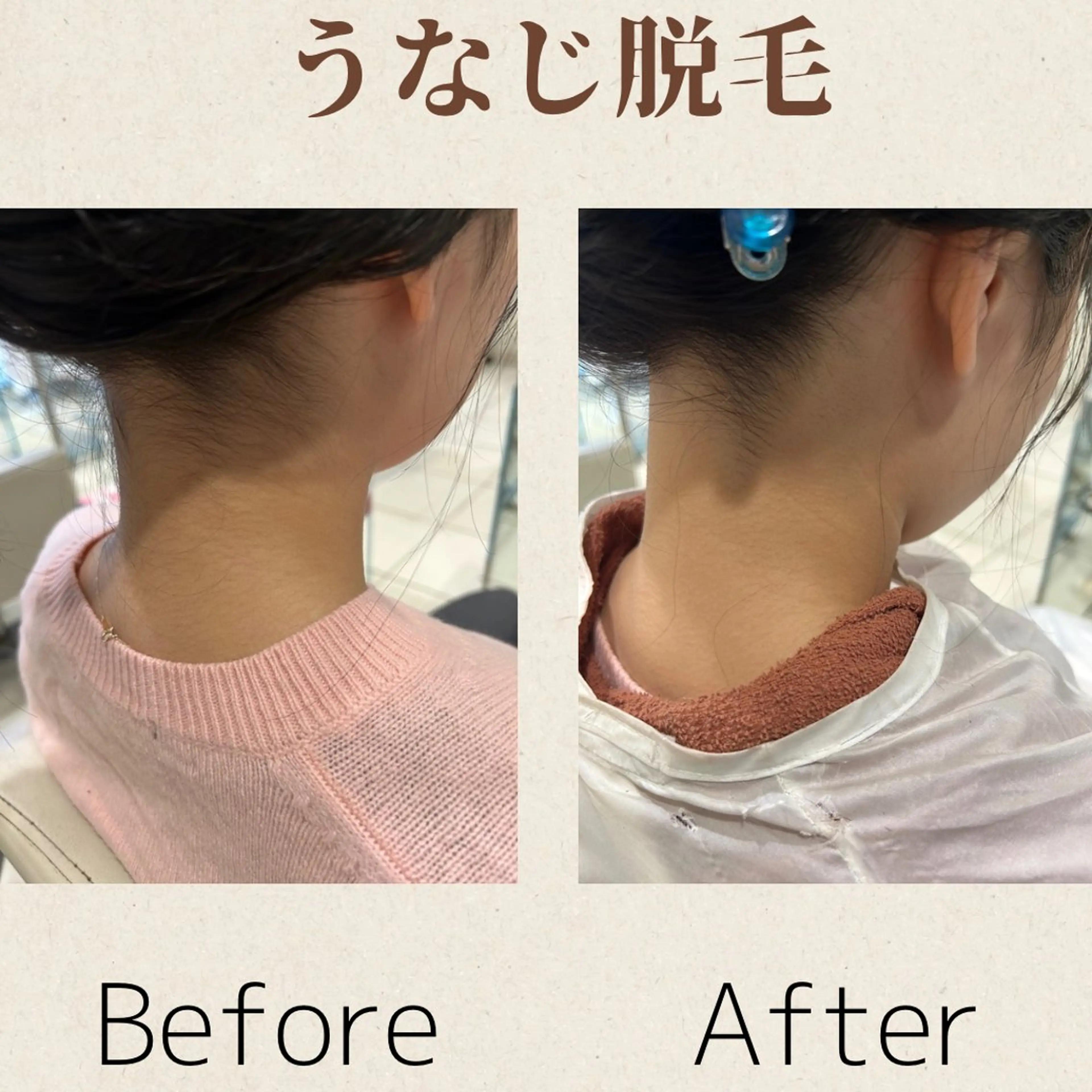 脱毛 MODE K's 白石彩夏のエステ・リラクイメージ