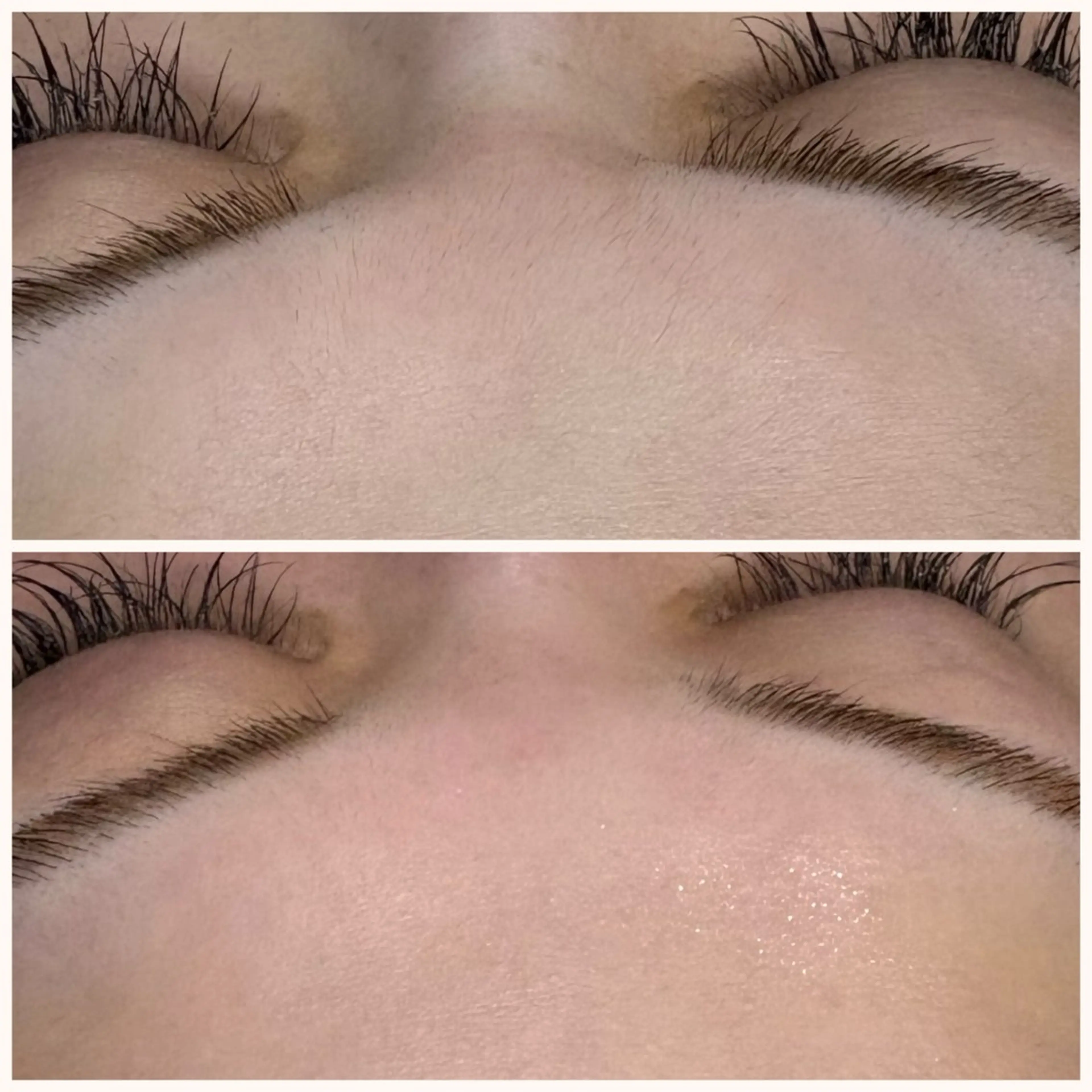 エステ A"-HILU （アーヒル)のエステ・リラクイメージ