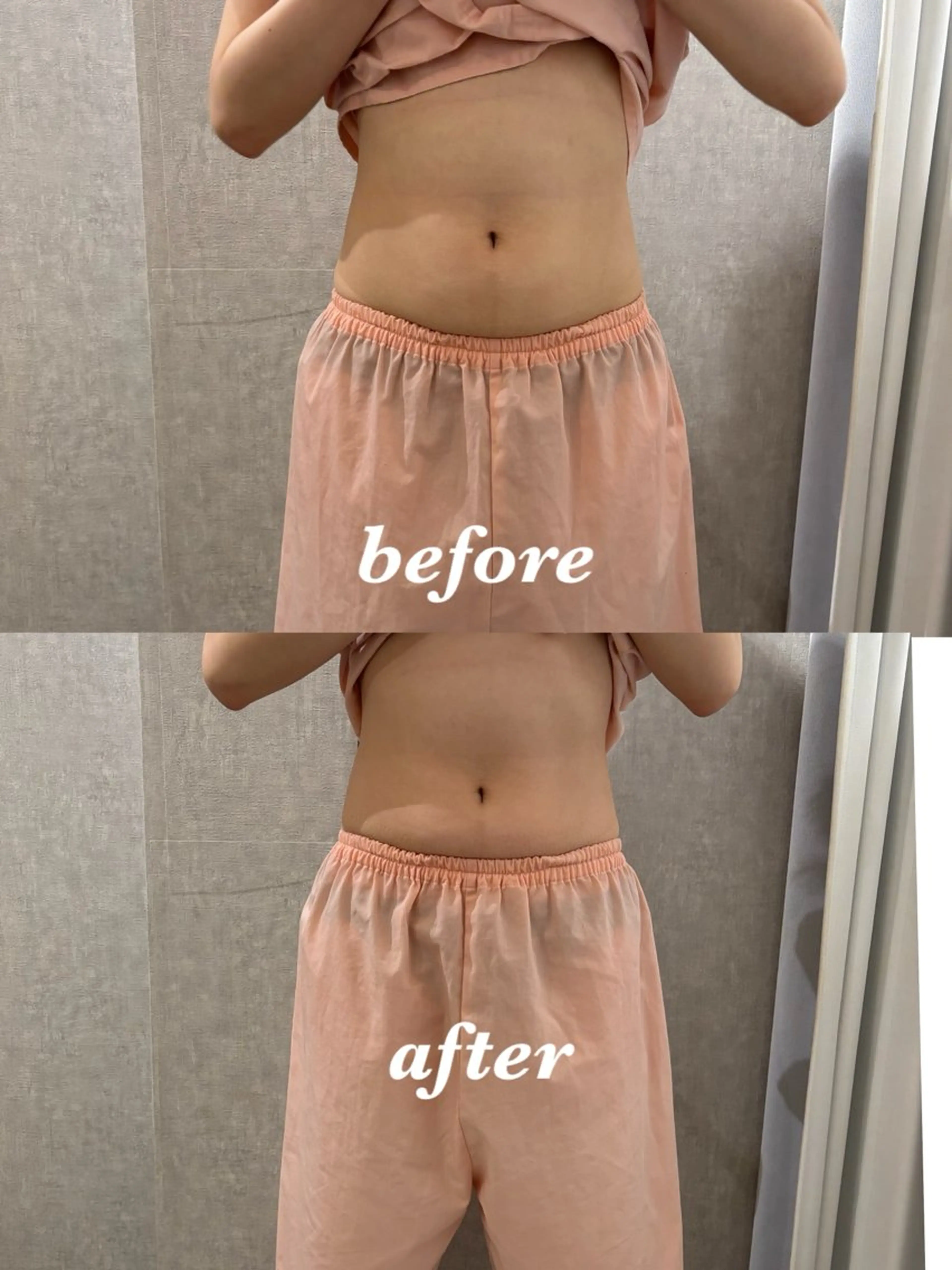 メンズ 腸活サポート みなみののエステ・リラクイメージ