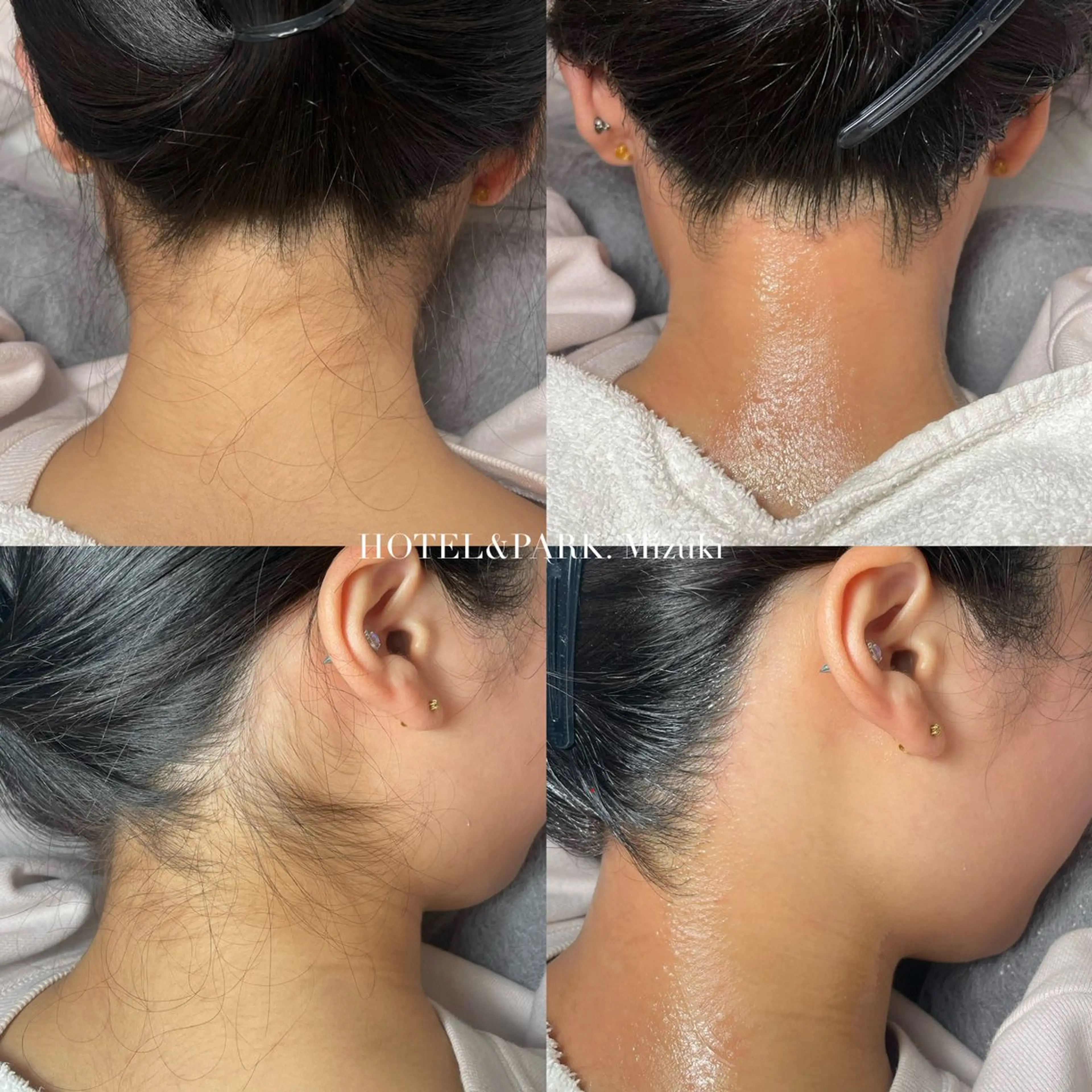 ロング 脱毛 HOTEL&PARK . ワックス脱毛のエステ・リラクイメージ