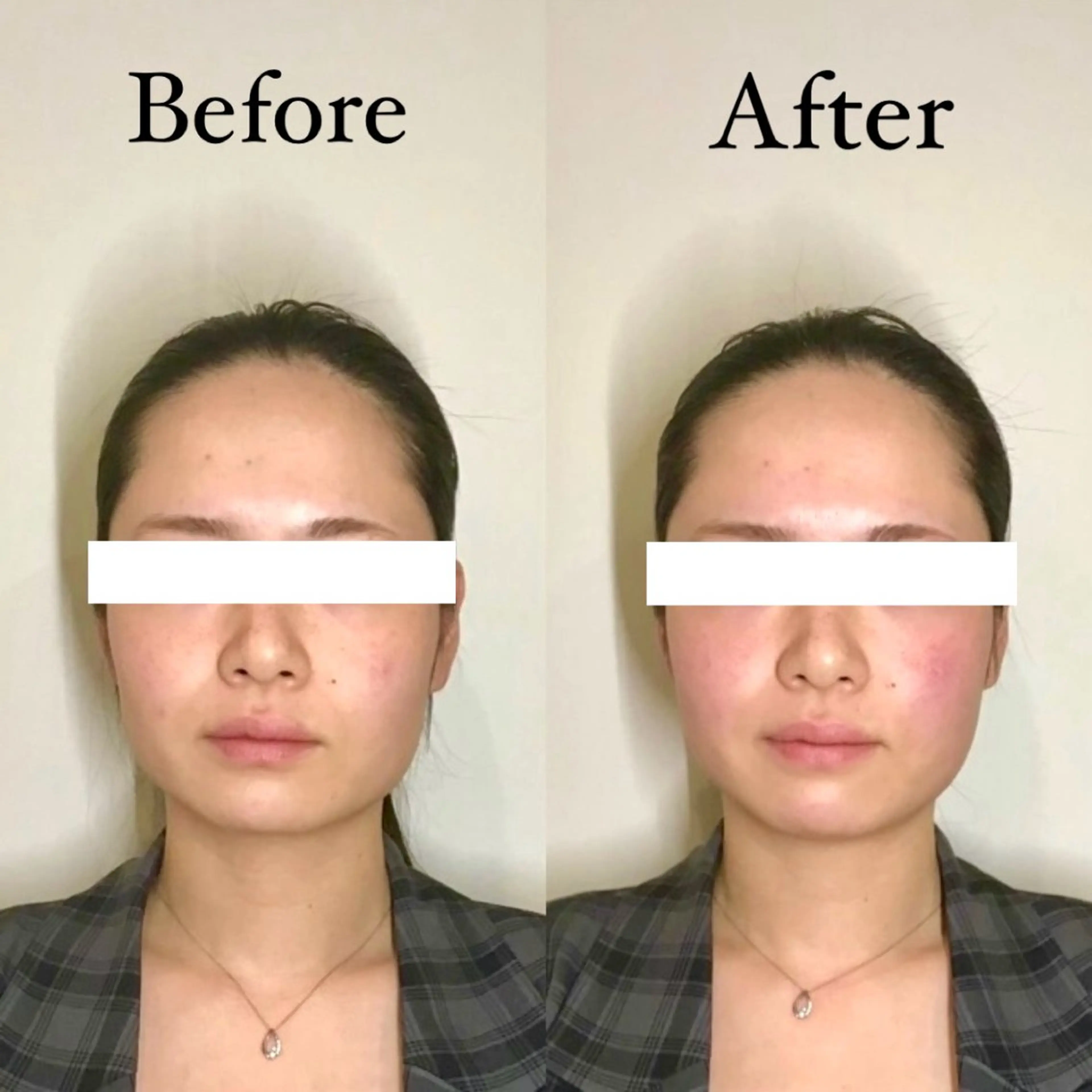 Hari Lounge恵比寿所属・chika🦋 ハリラウンジ恵比寿のエステ・リラクイメージ