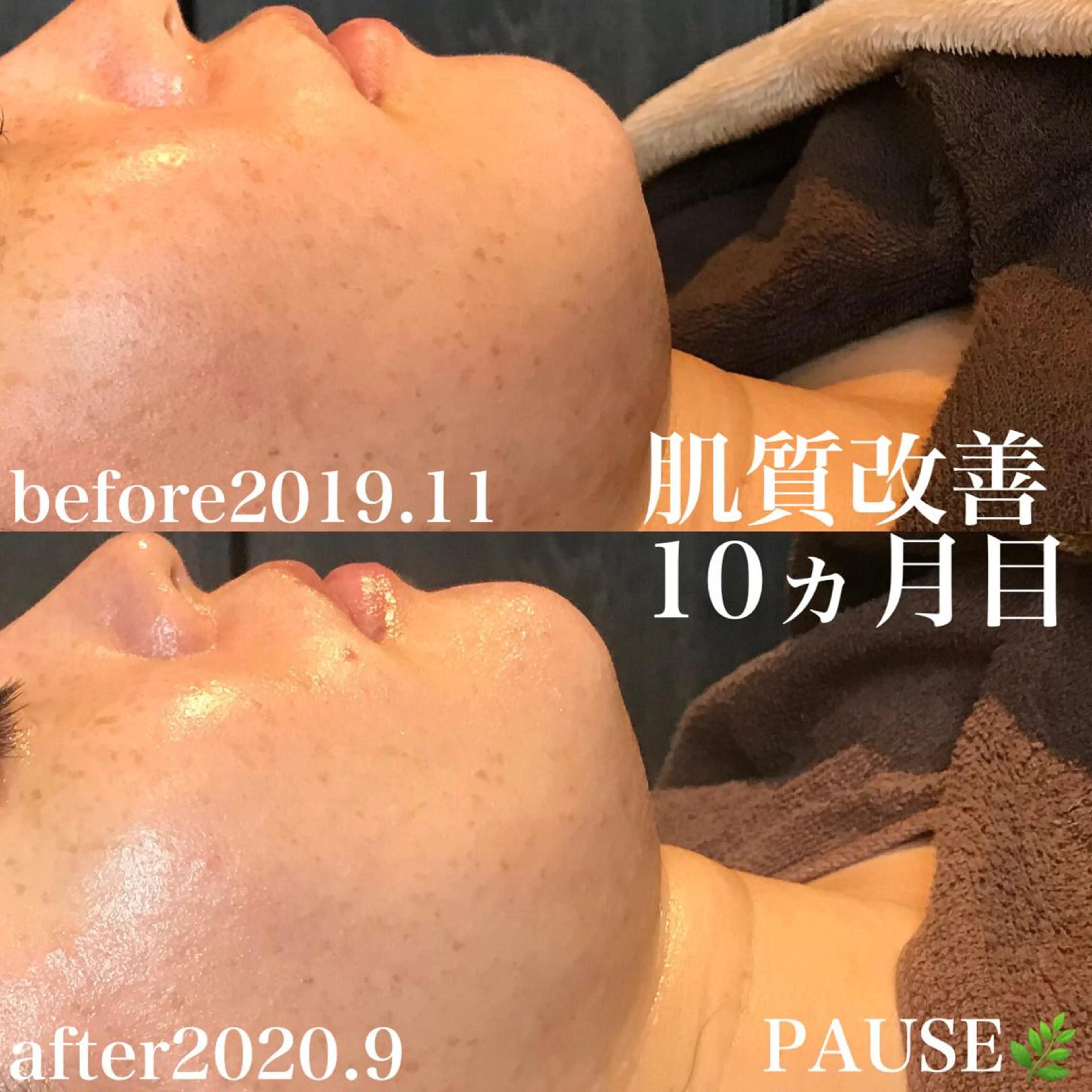 エステ 浜野 恵美のエステ・リラクイメージ