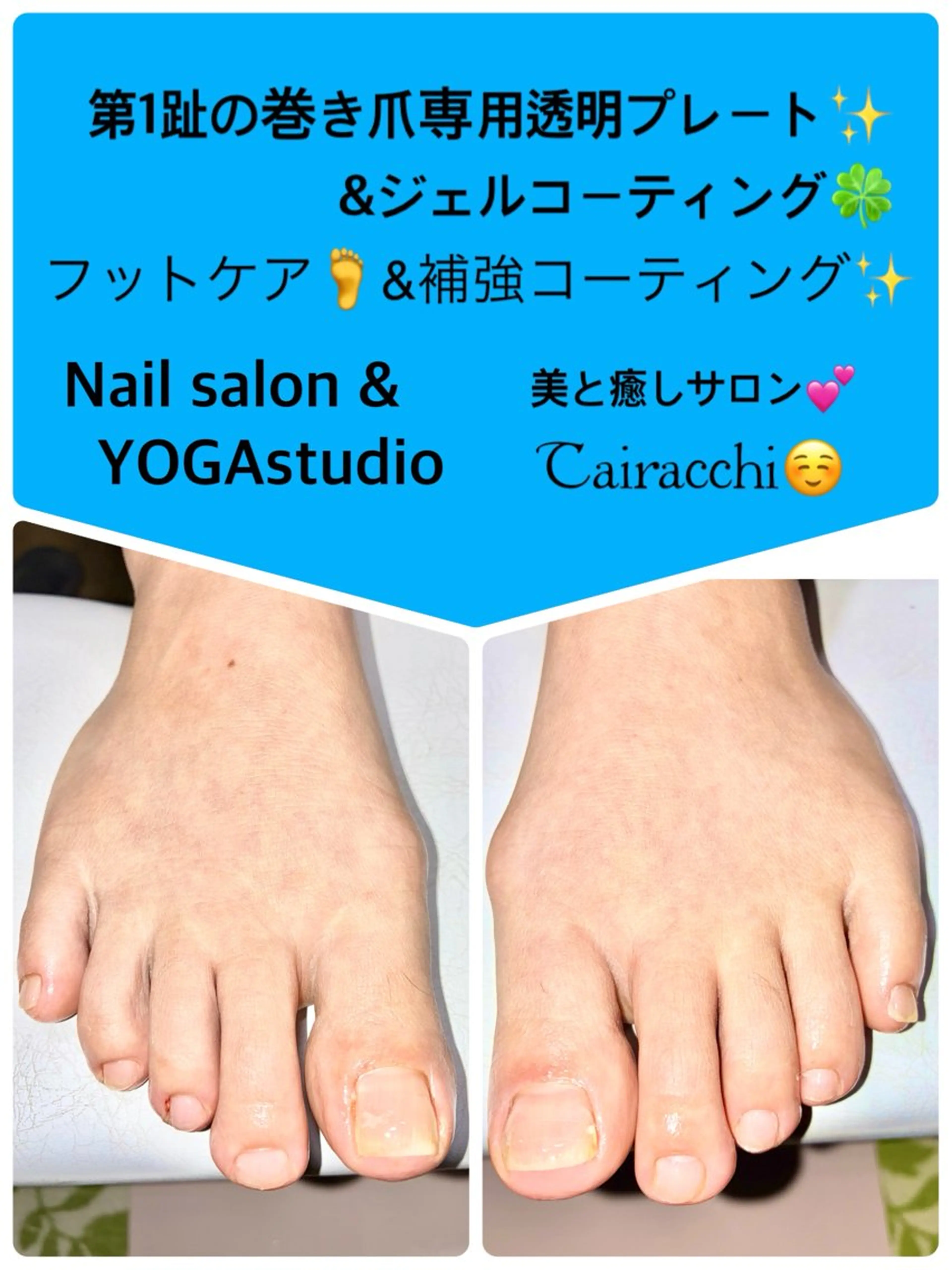 ネイル フットネイル Tairacchi ﾀｲﾗｯﾁのエステ・リラクイメージ