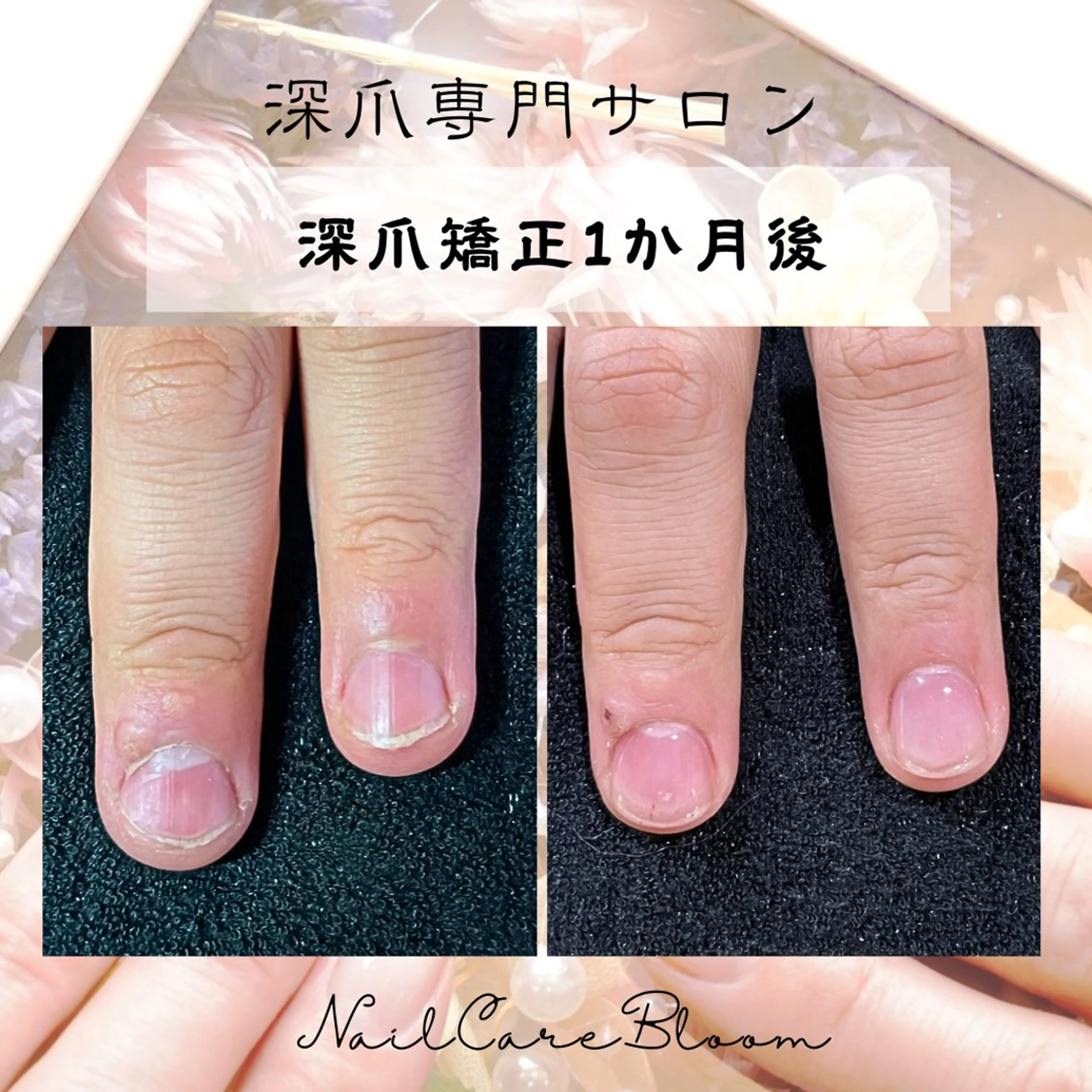 ネイル ピンク ハンドケア 深爪専門nail care bloomのネイルデザイン
