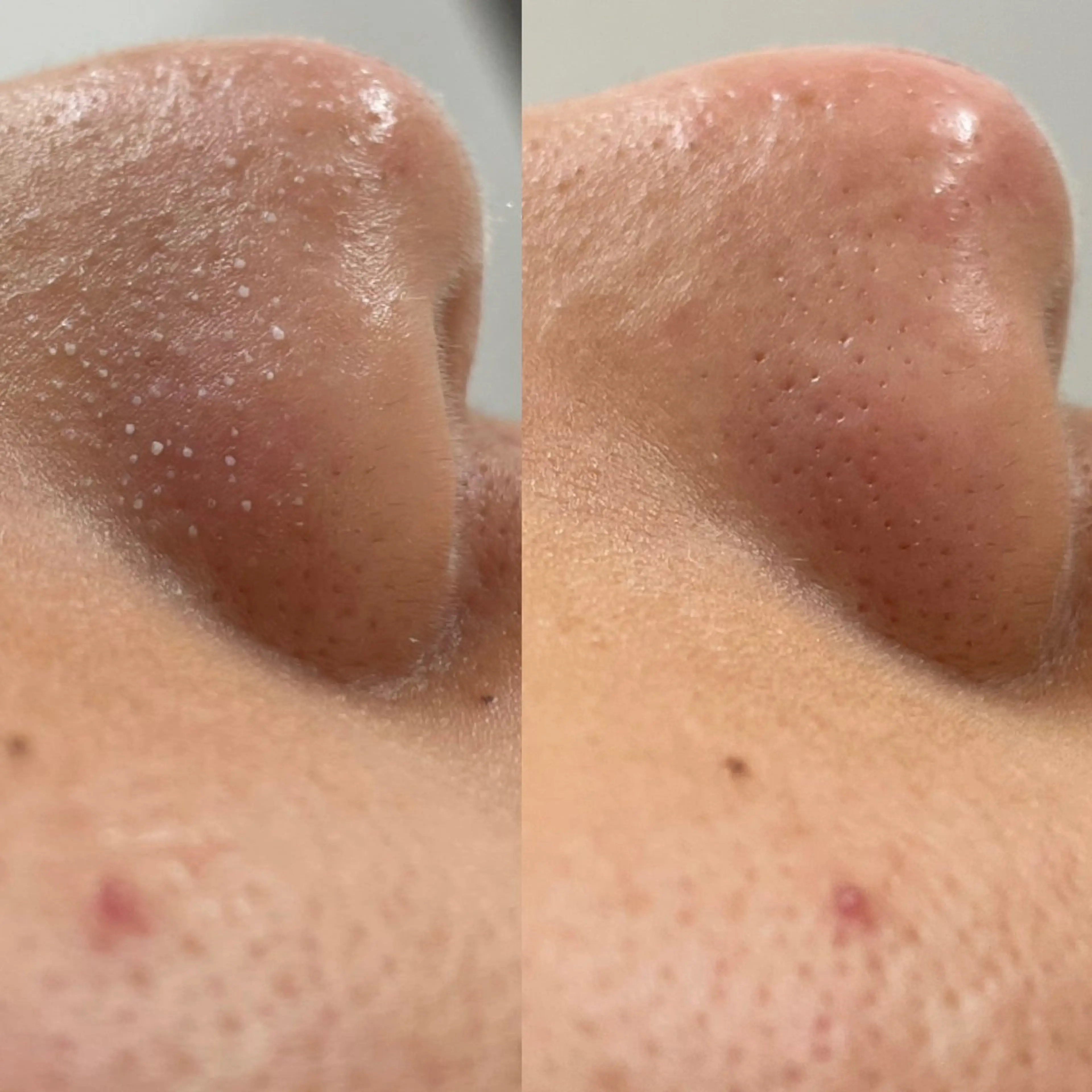 【特別価格】ラッシュリフト＋デザイニングアイブロウ+小鼻ケア（撮影あり）の写真