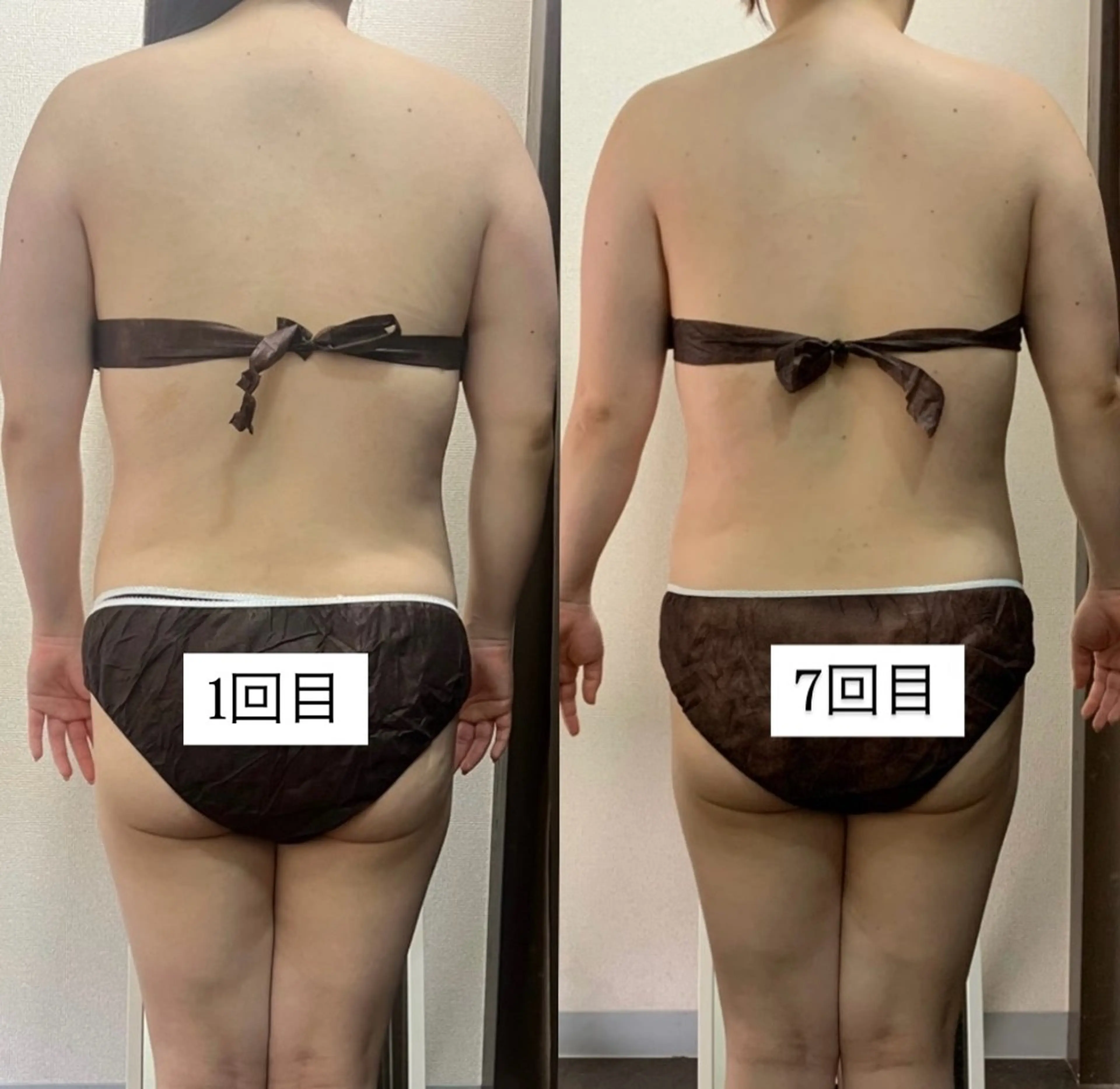 ハイパーナイフ専門店　Salon de COCO所属・Salon de COCOのエステ・リラクイメージ