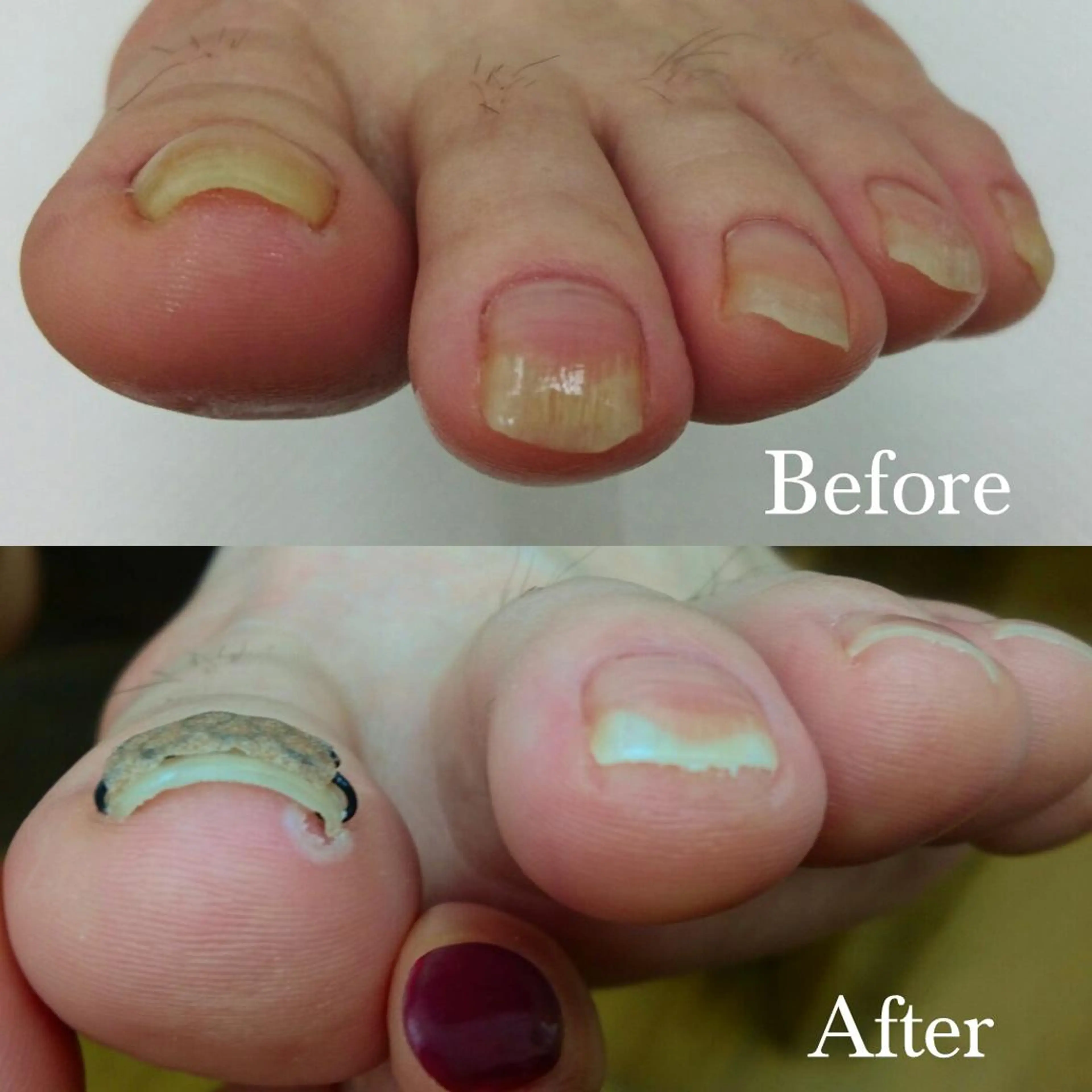 東 あきらのネイルデザイン