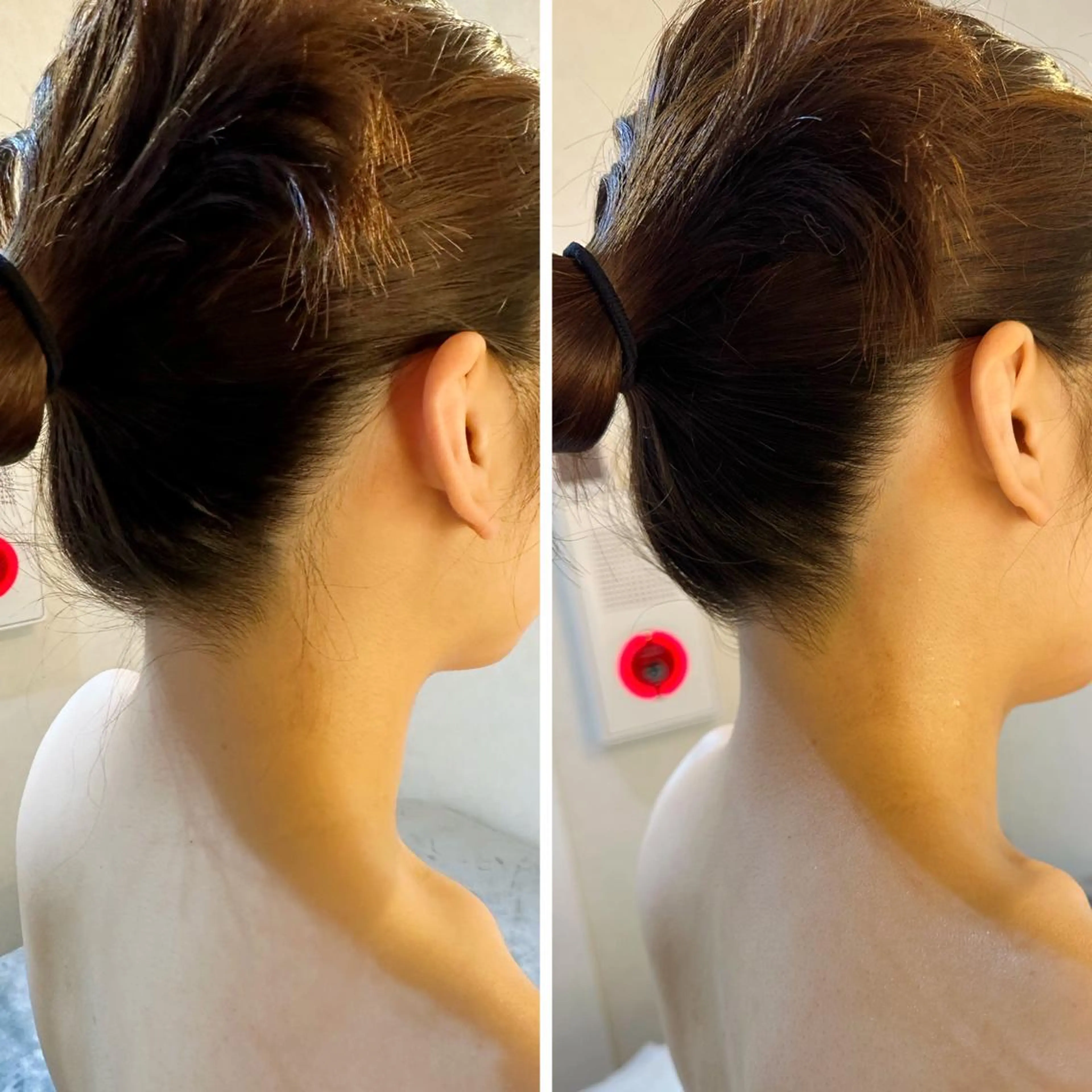 うなじ脱毛/美肌脱毛 LABELのエステ・リラクイメージ