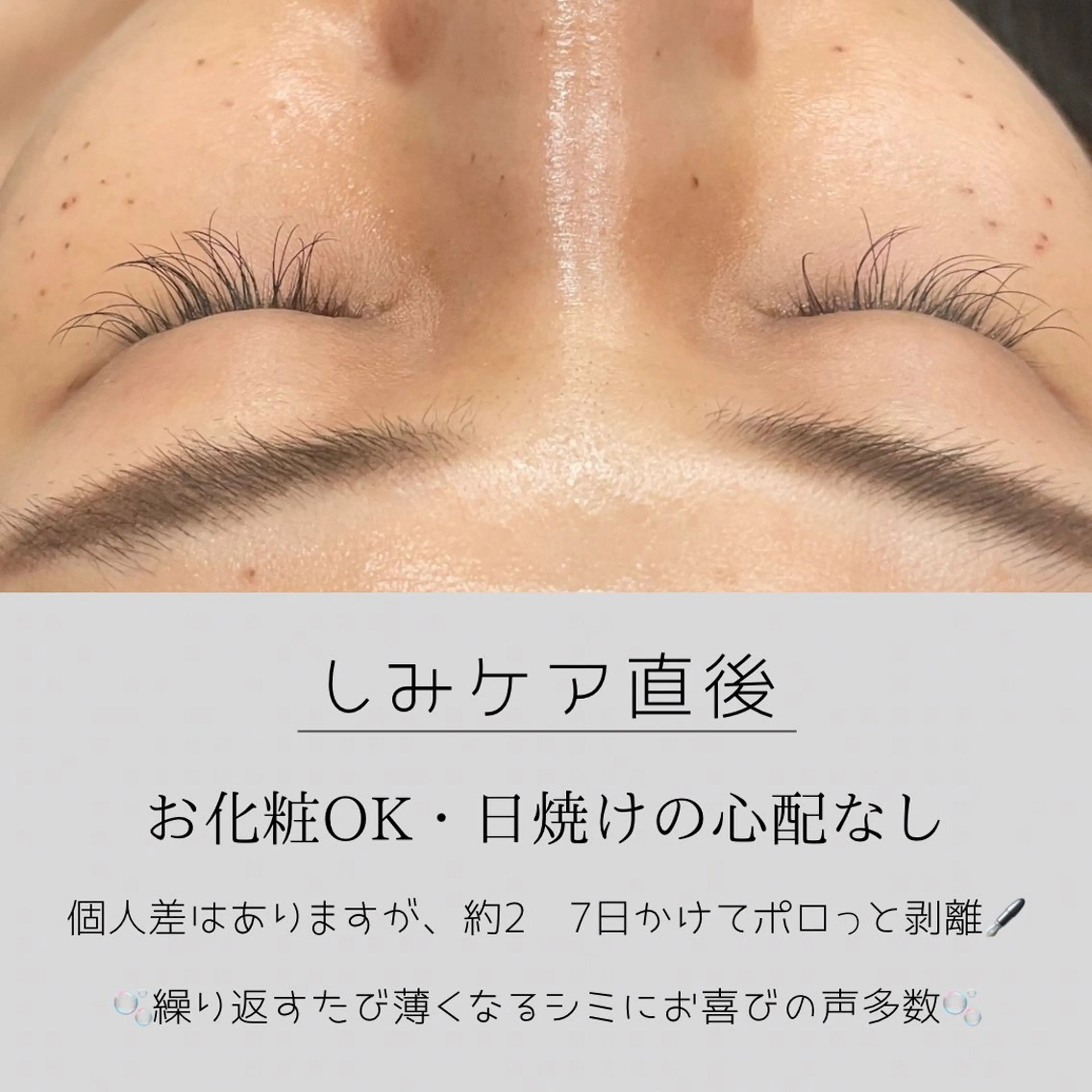 LiZA エステティックサロンのエステ・リラクイメージ