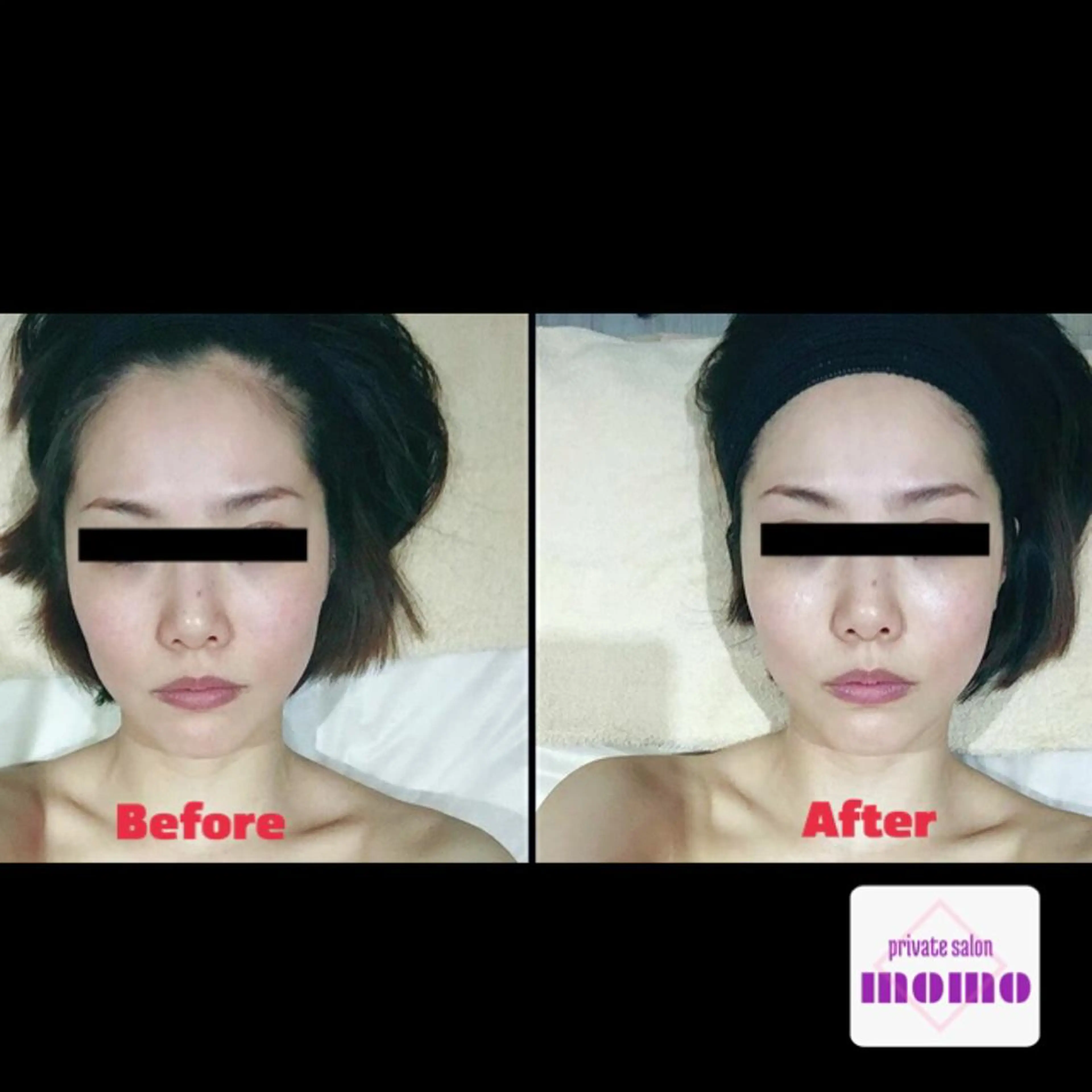 代表 MOMOのエステ・リラクイメージ