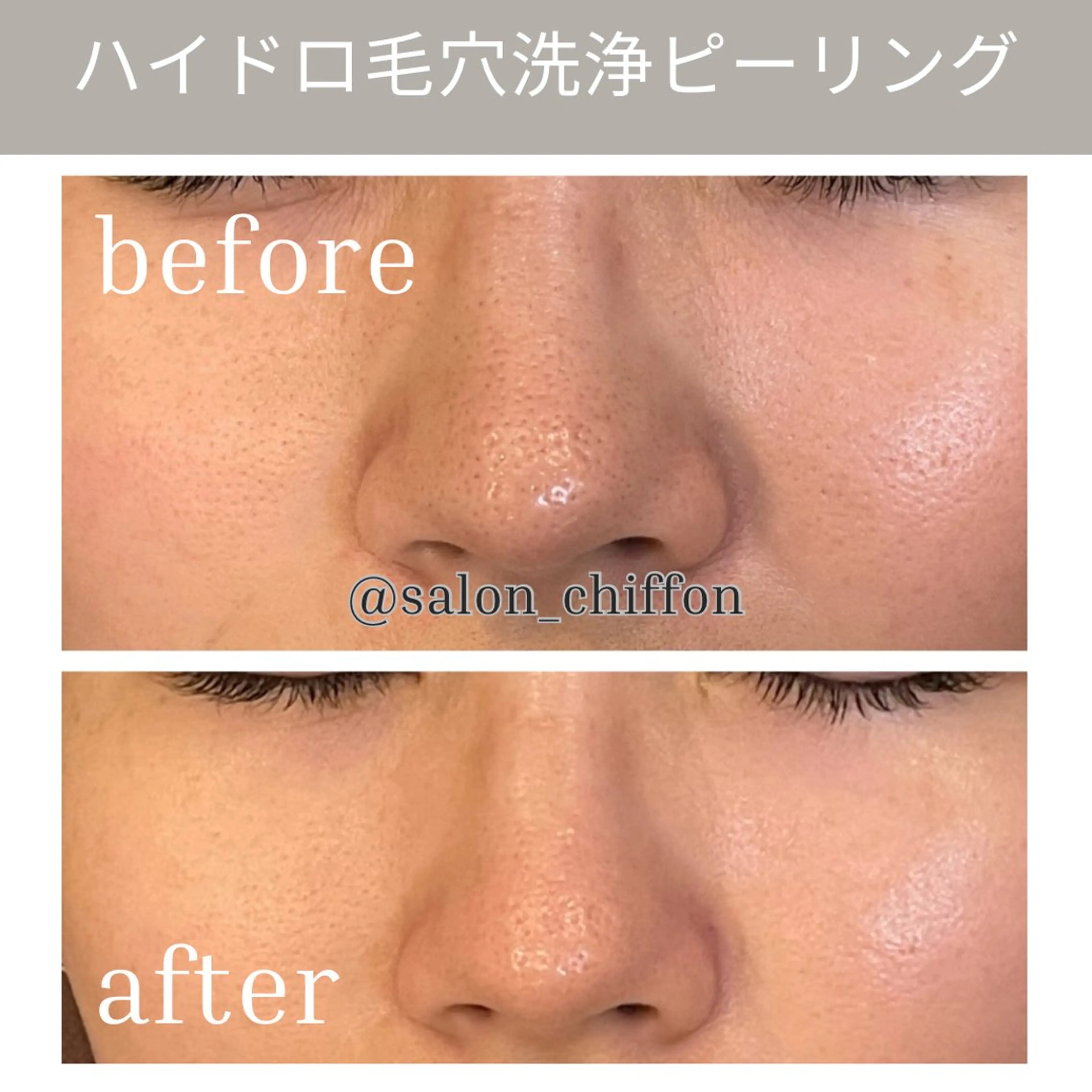 肌質改善エステ chiffonのエステ・リラクイメージ