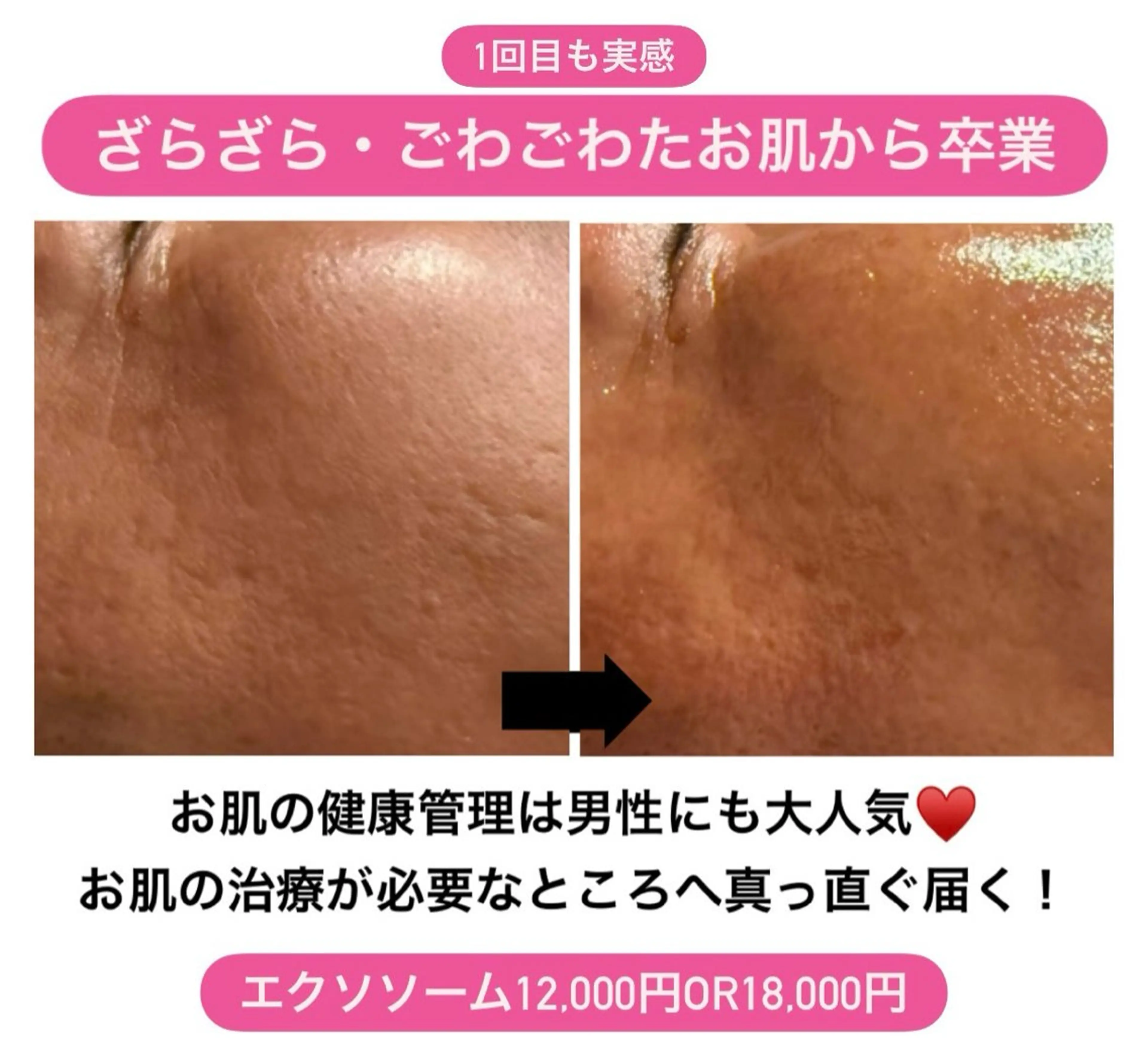 エステ 太田 女久美のエステ・リラクイメージ