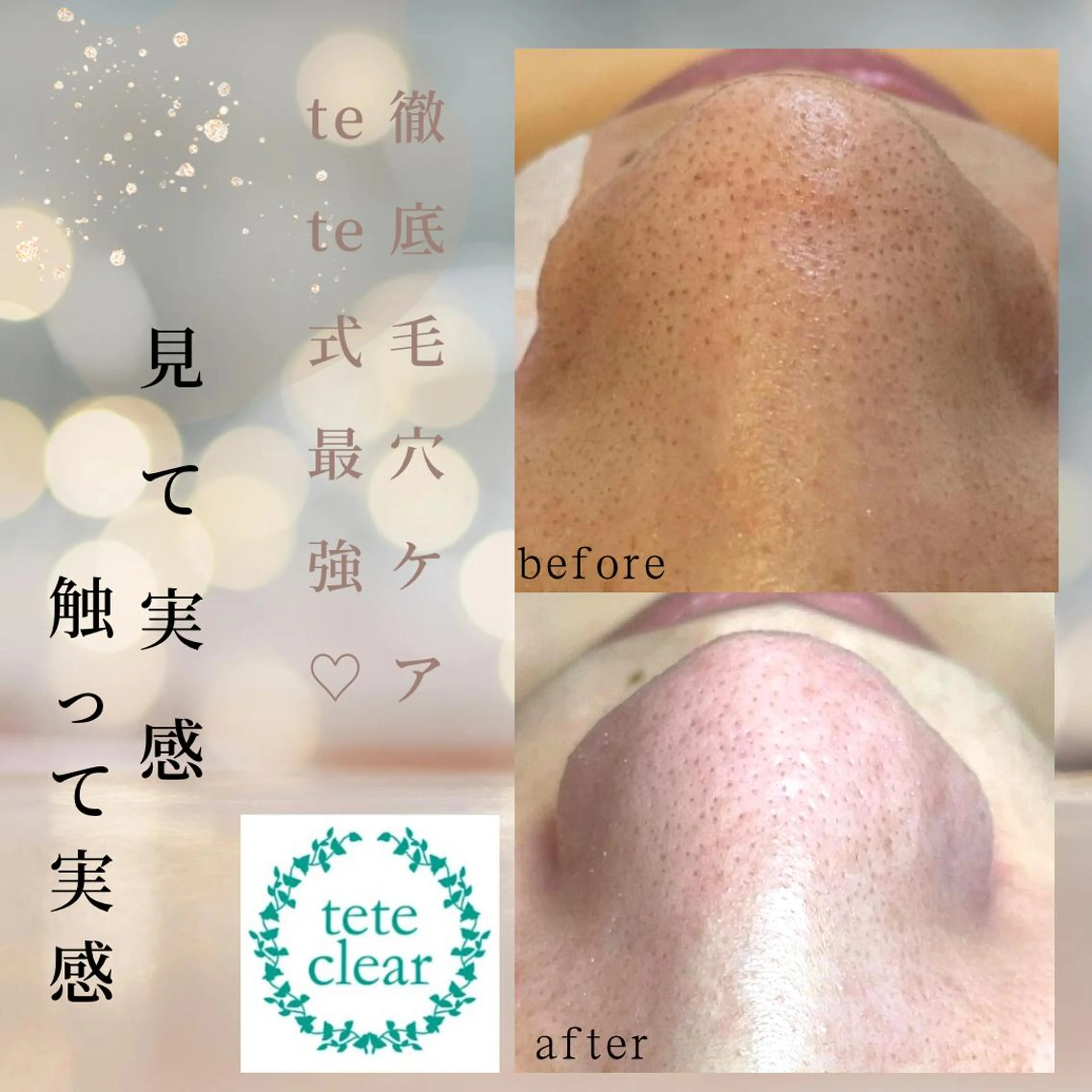 夕希 毛穴と脱毛特化サロンのエステ・リラクイメージ