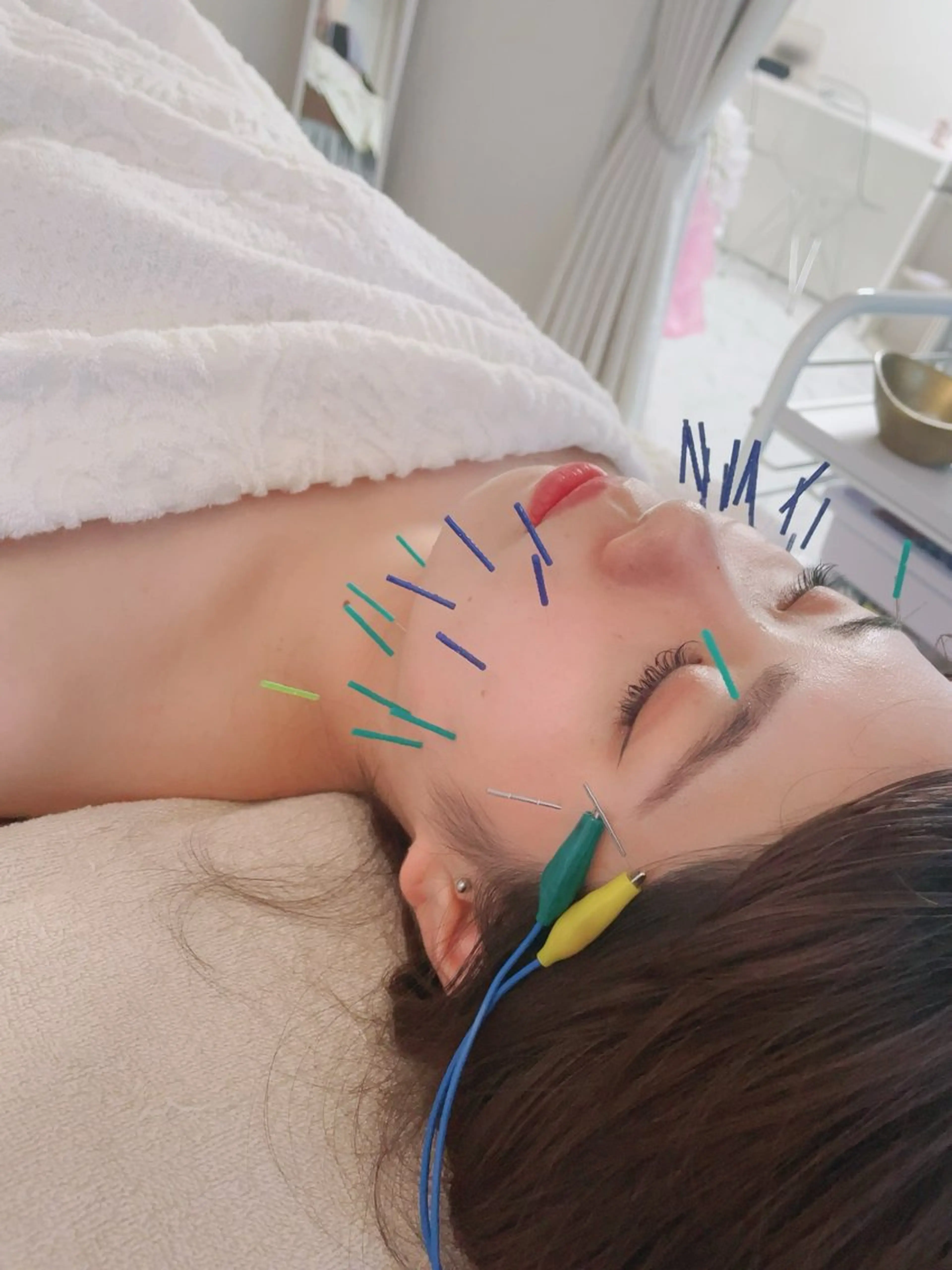 エステ リラク 美容鍼・鍼灸専門❤✨ 近藤めぐみのエステ・リラクイメージ