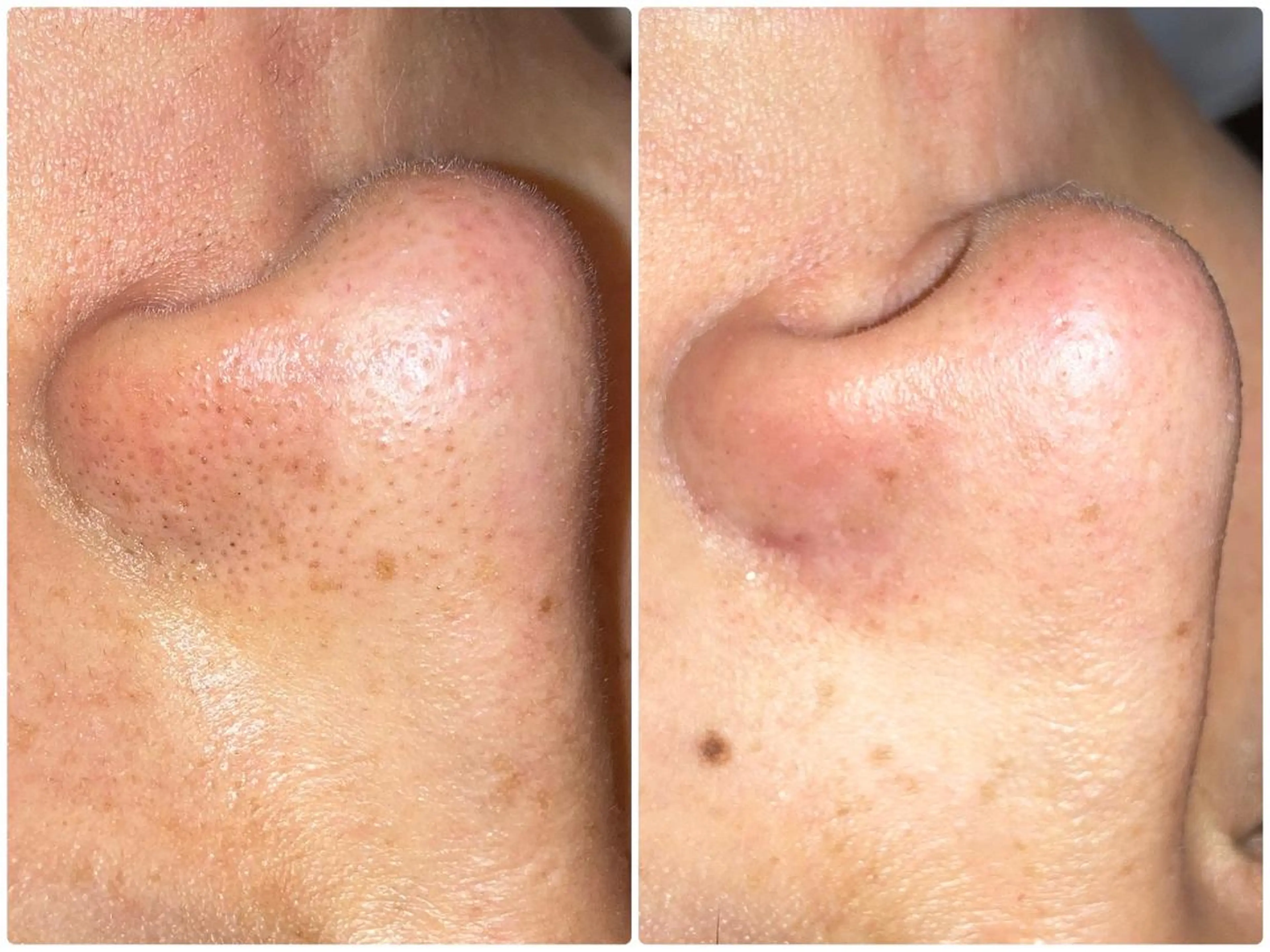 ぷるる 練馬のエステ・リラクイメージ