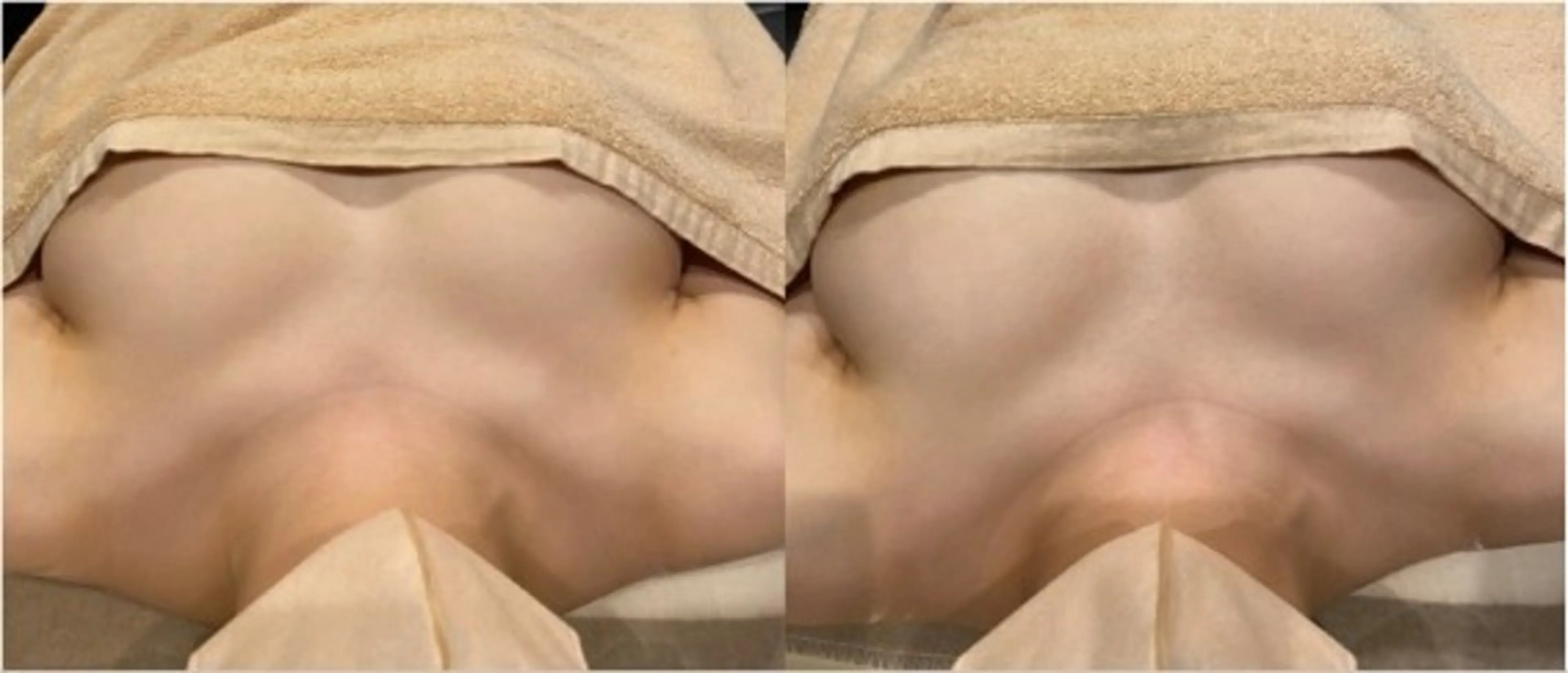 エステ バストアップ専門店B leuBlanc田原のエステ・リラクイメージ