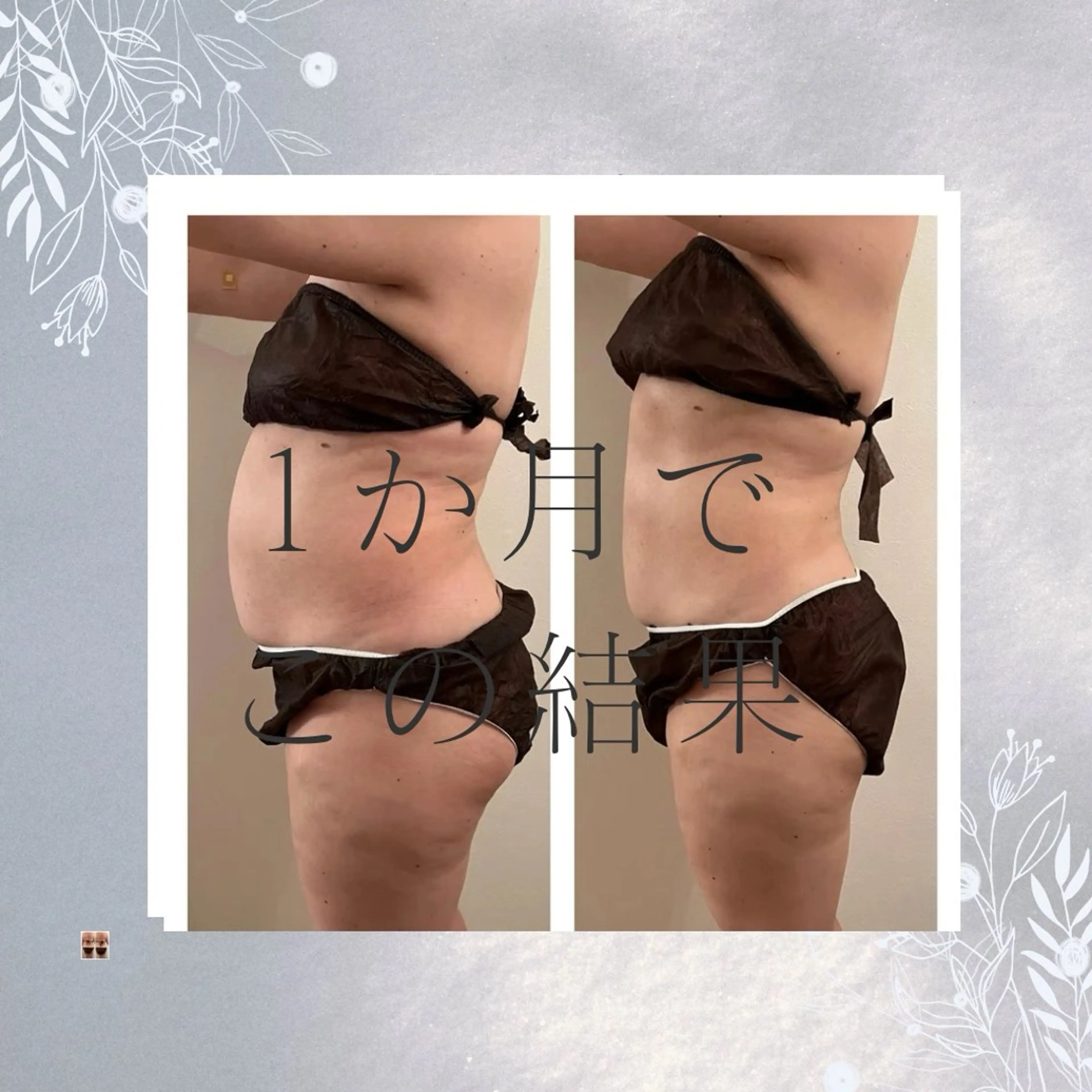 エステ Relative ララティブのエステ・リラクイメージ