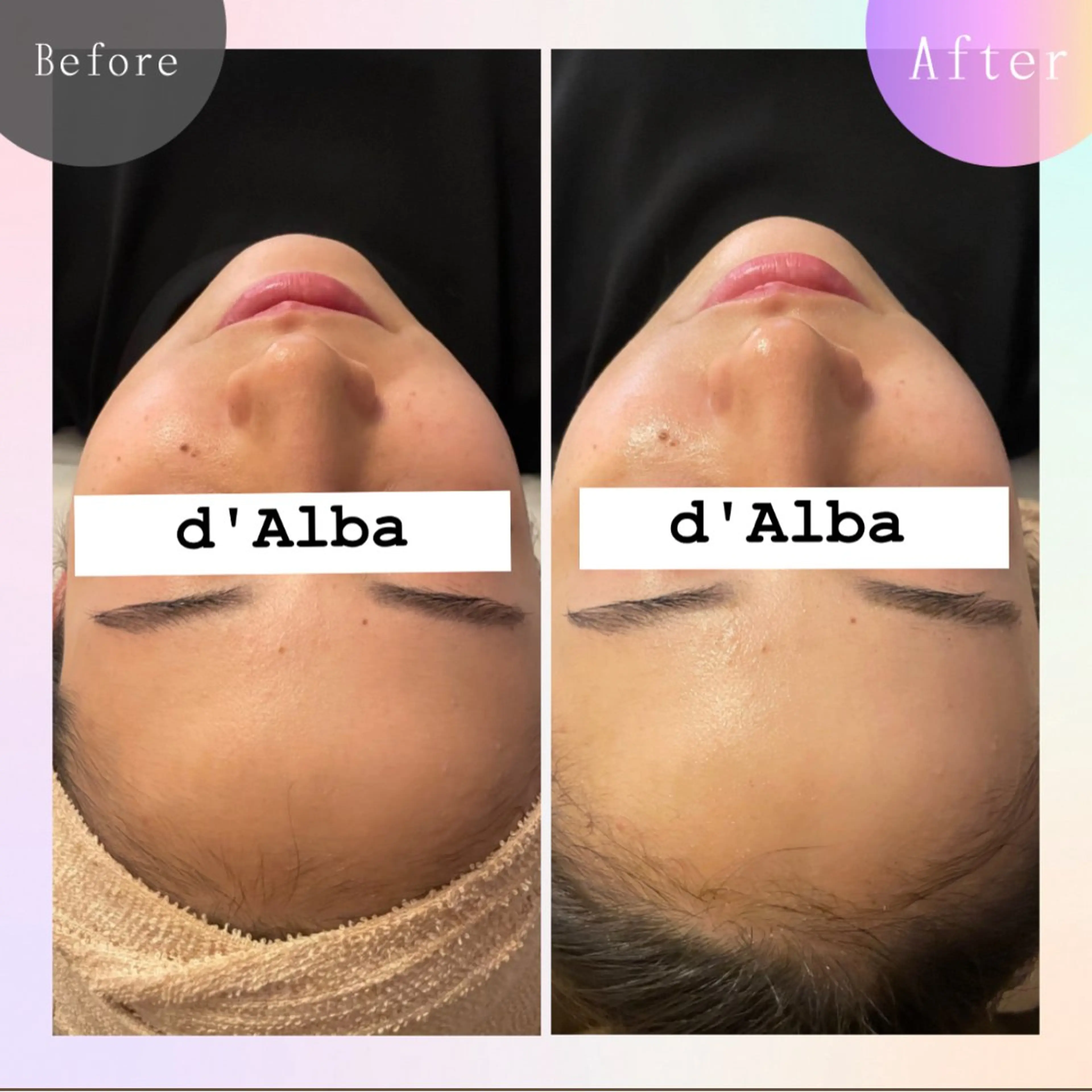 毛穴改善サロン d'Alba大阪住吉のエステ・リラクイメージ