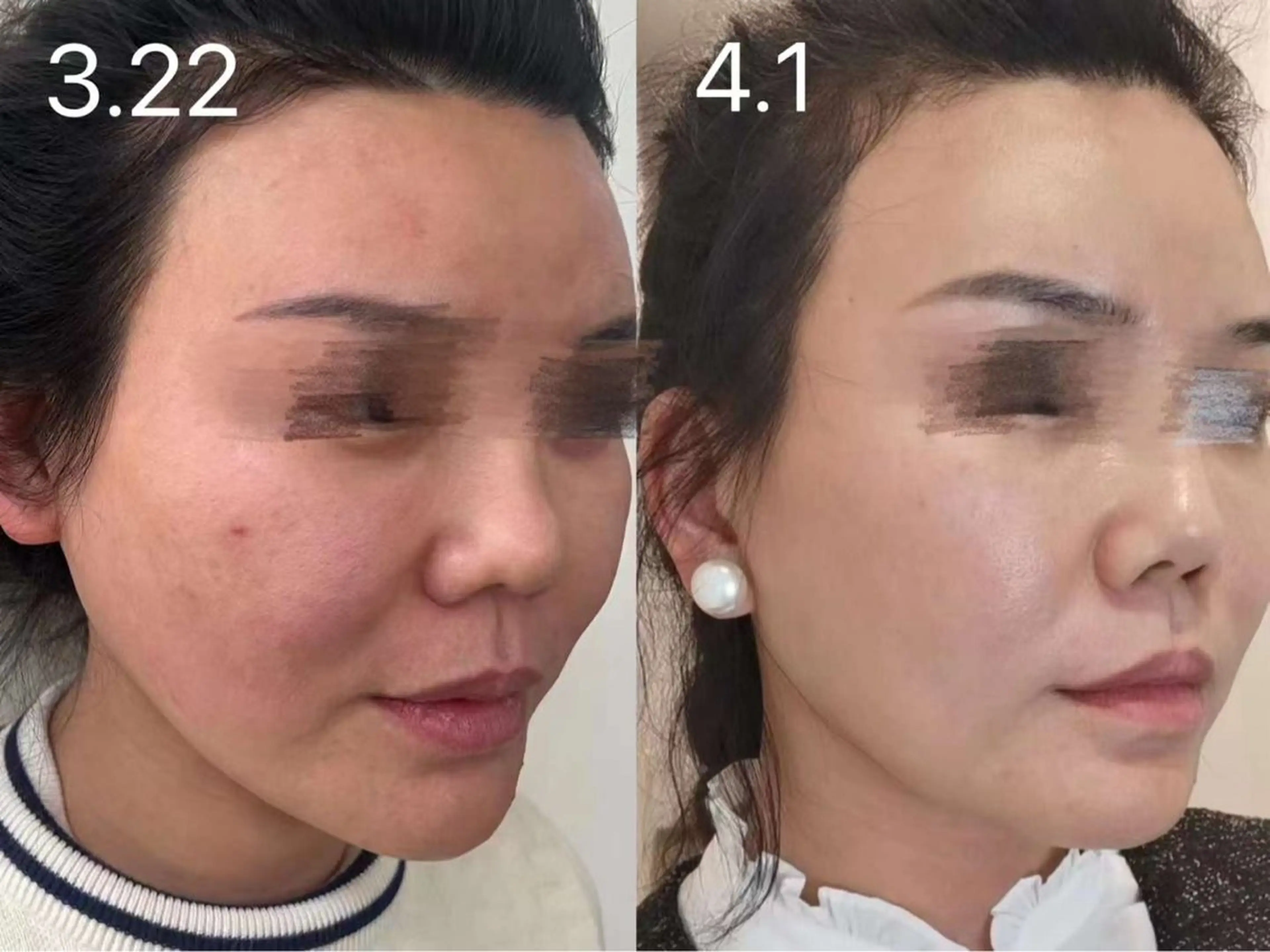 マツエク・マツパ エステ aliaハーブ水光店 エステティシャン募集のエステ・リラクイメージ