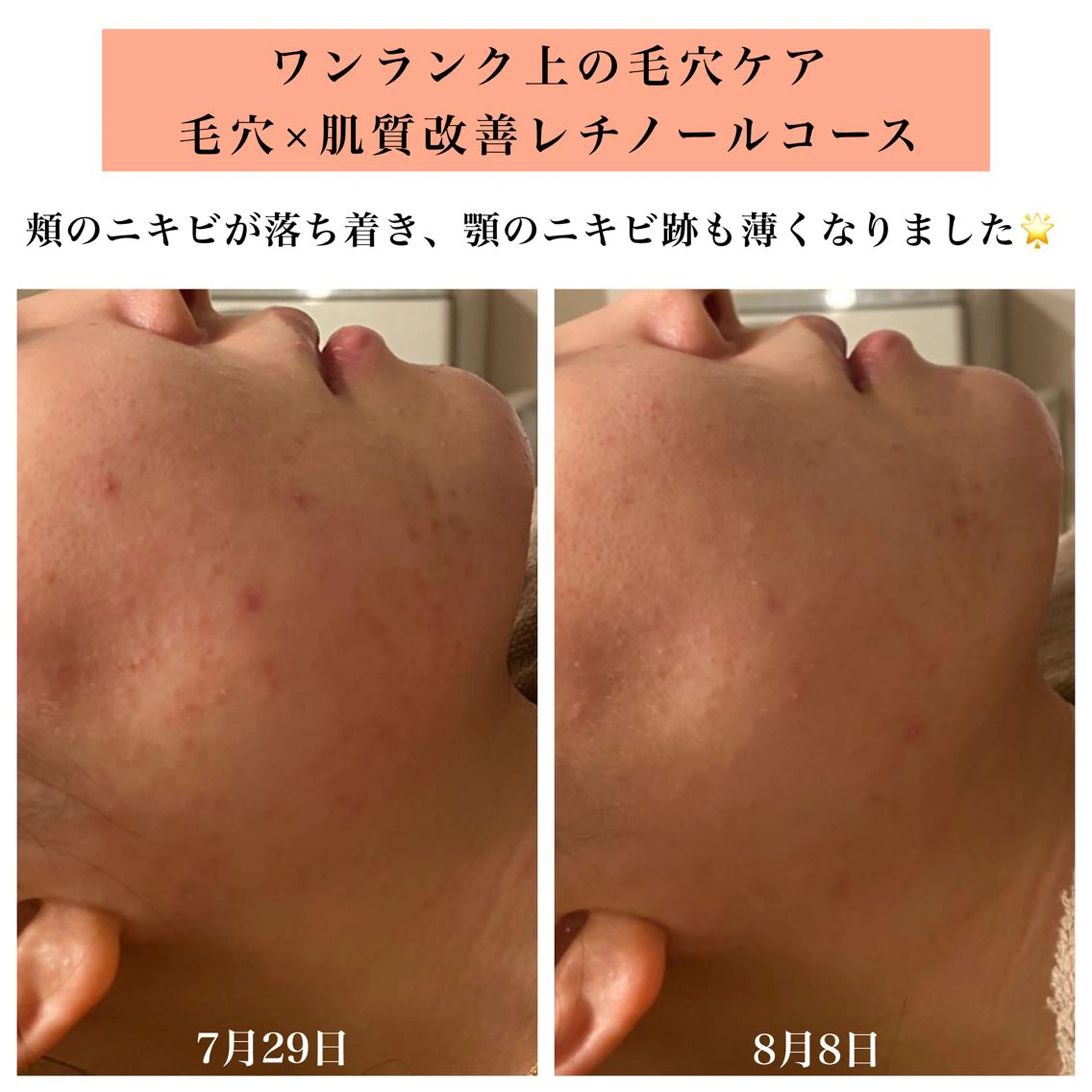 エステ リラク Bellesthe (ベルエステ)のエステ・リラクイメージ