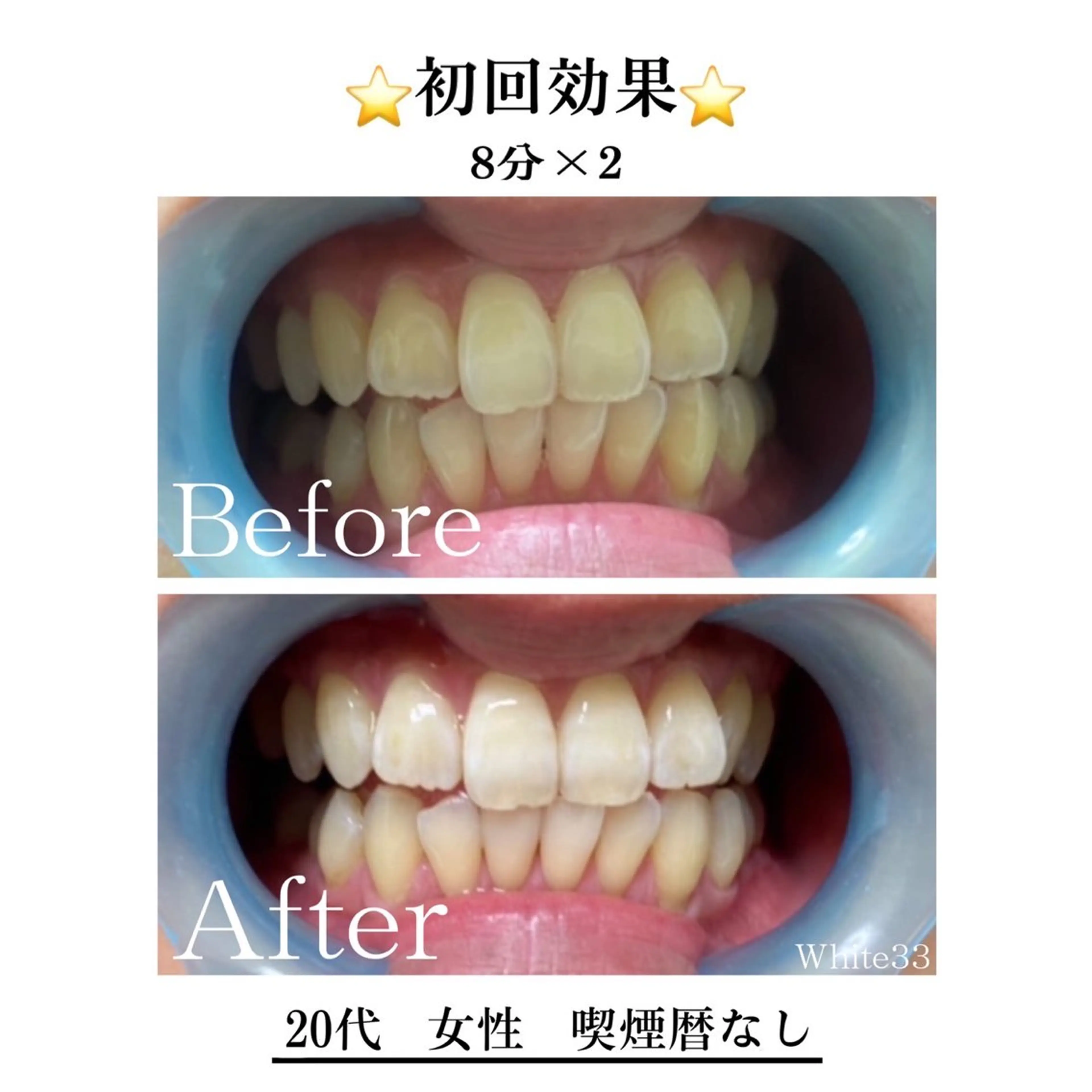 セルフホワイトニング White33大名のその他イメージ