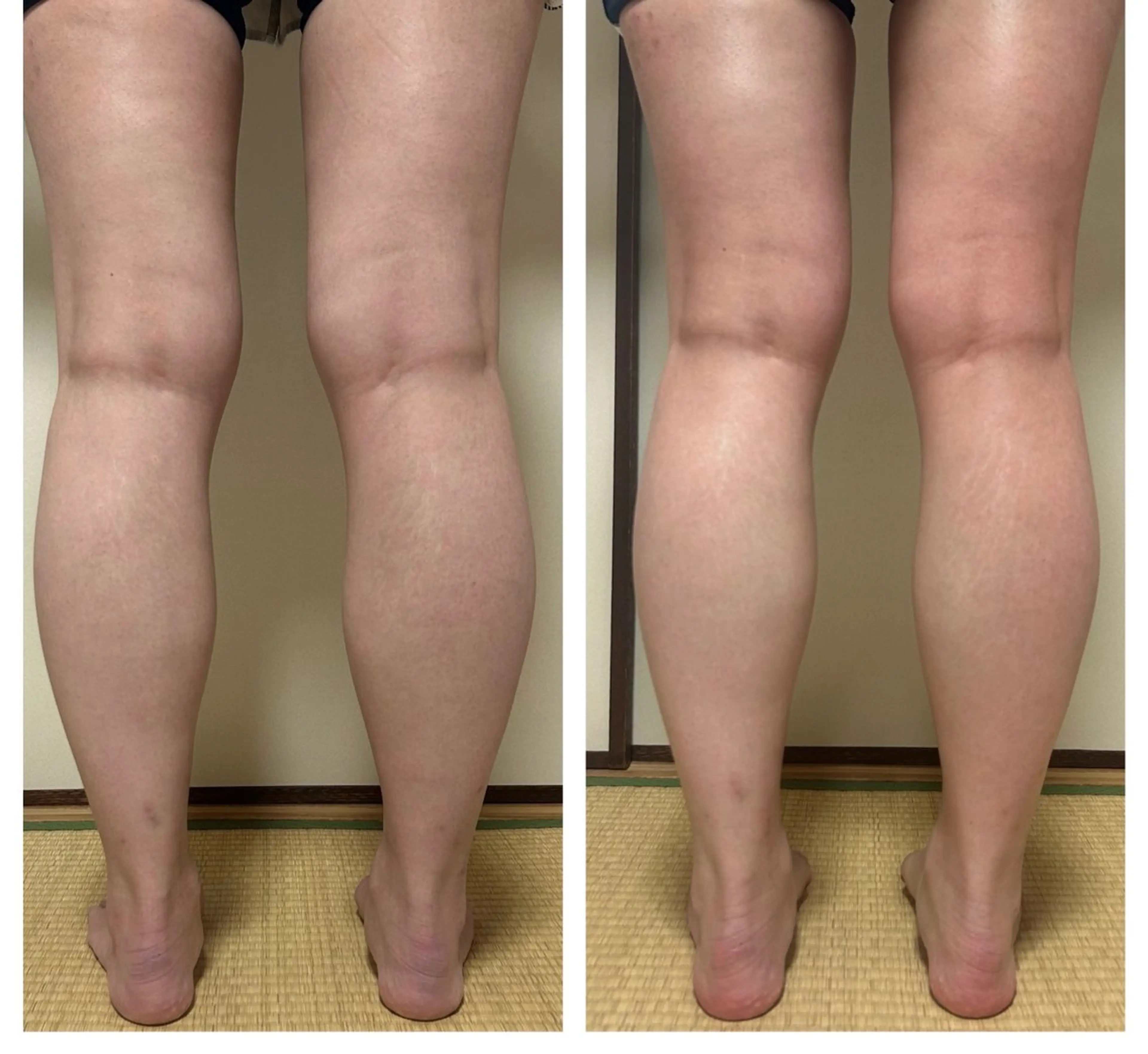 salon.plaisir（プレズィール）所属・酒井 瑠未のエステ・リラクイメージ