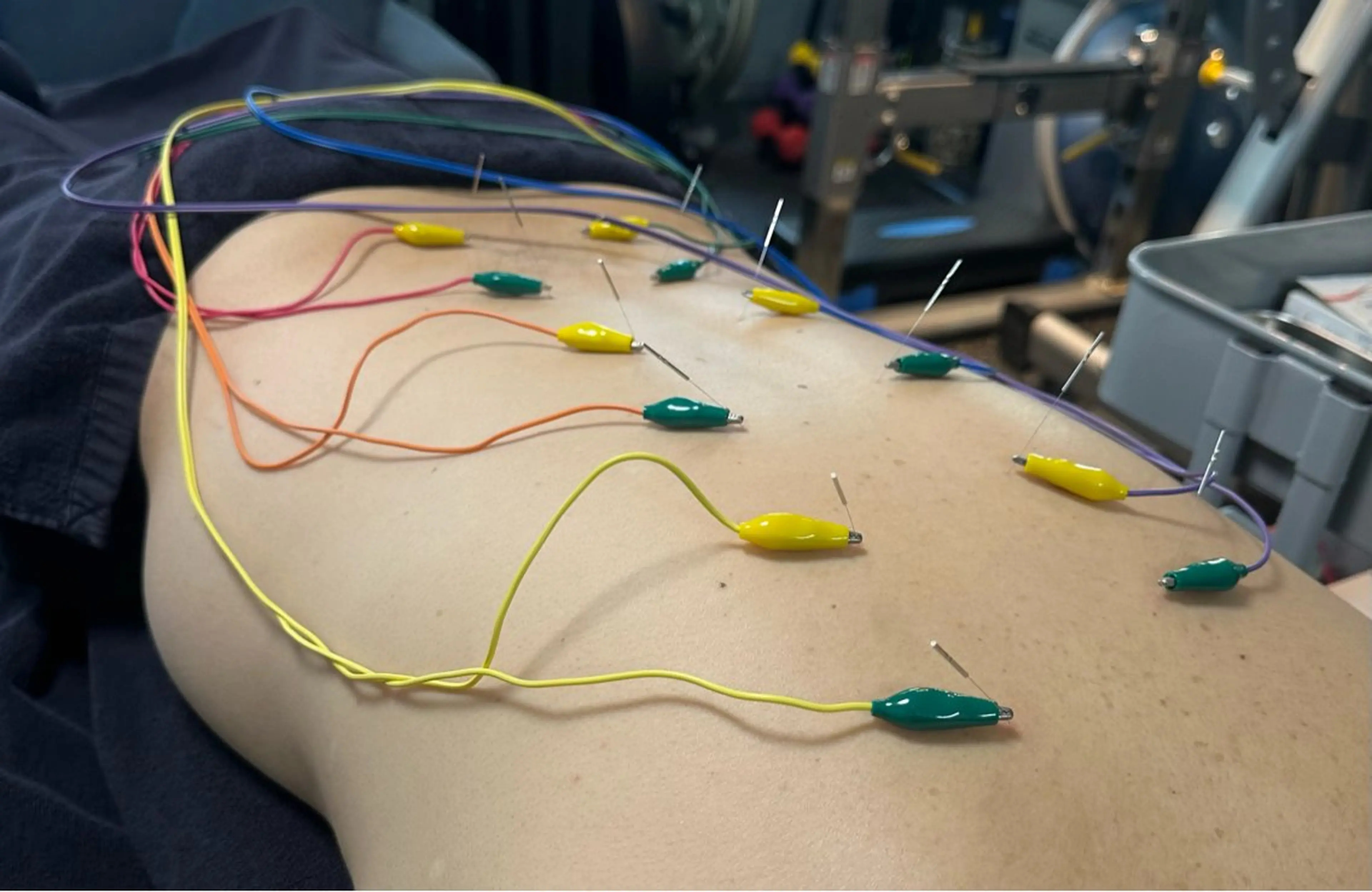 エステ リラク 小顔矯正・美容鍼 FLOW鍼灸整体院のエステ・リラクイメージ