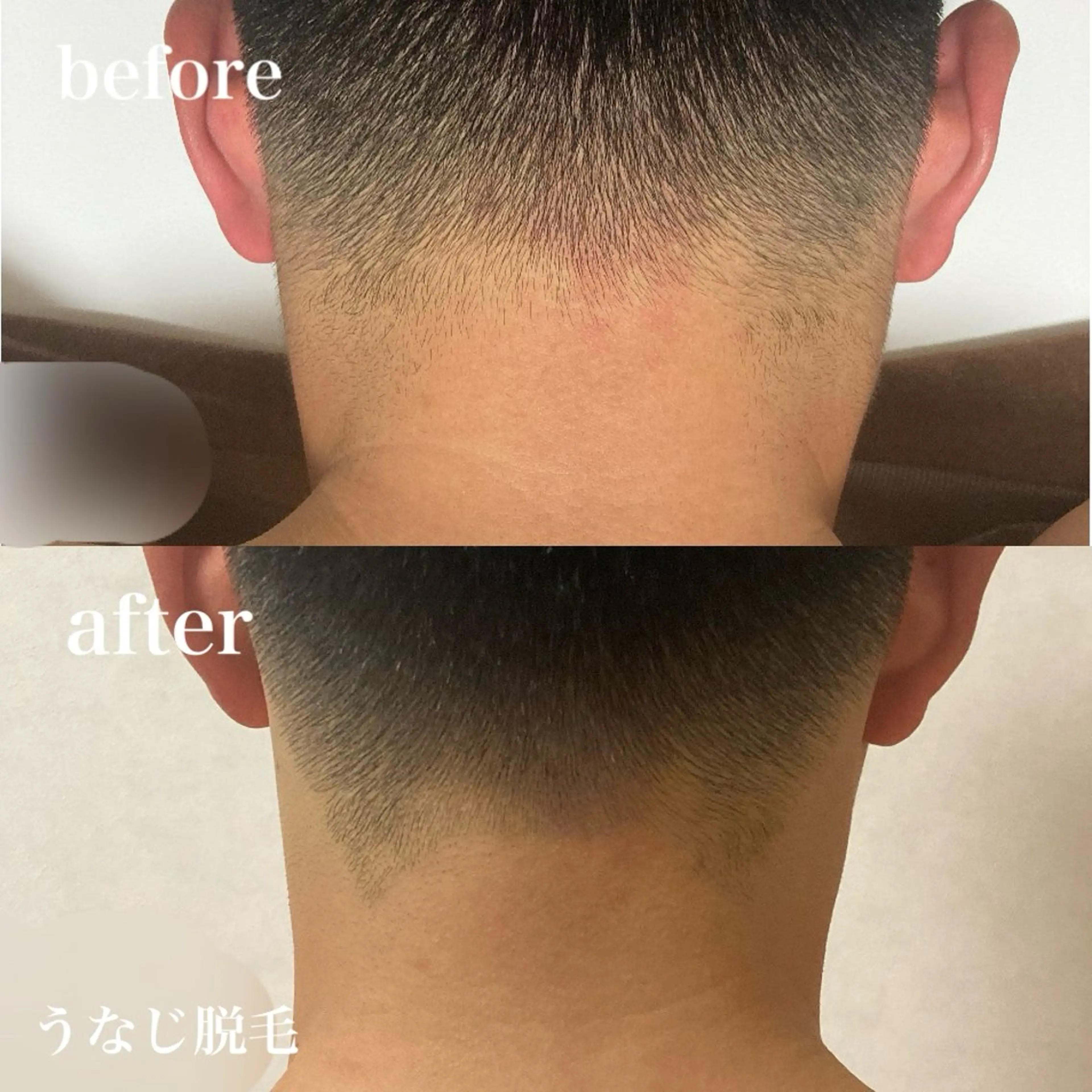 脱毛 磐田｜LAYLA 一番丁寧な脱毛店のエステ・リラクイメージ