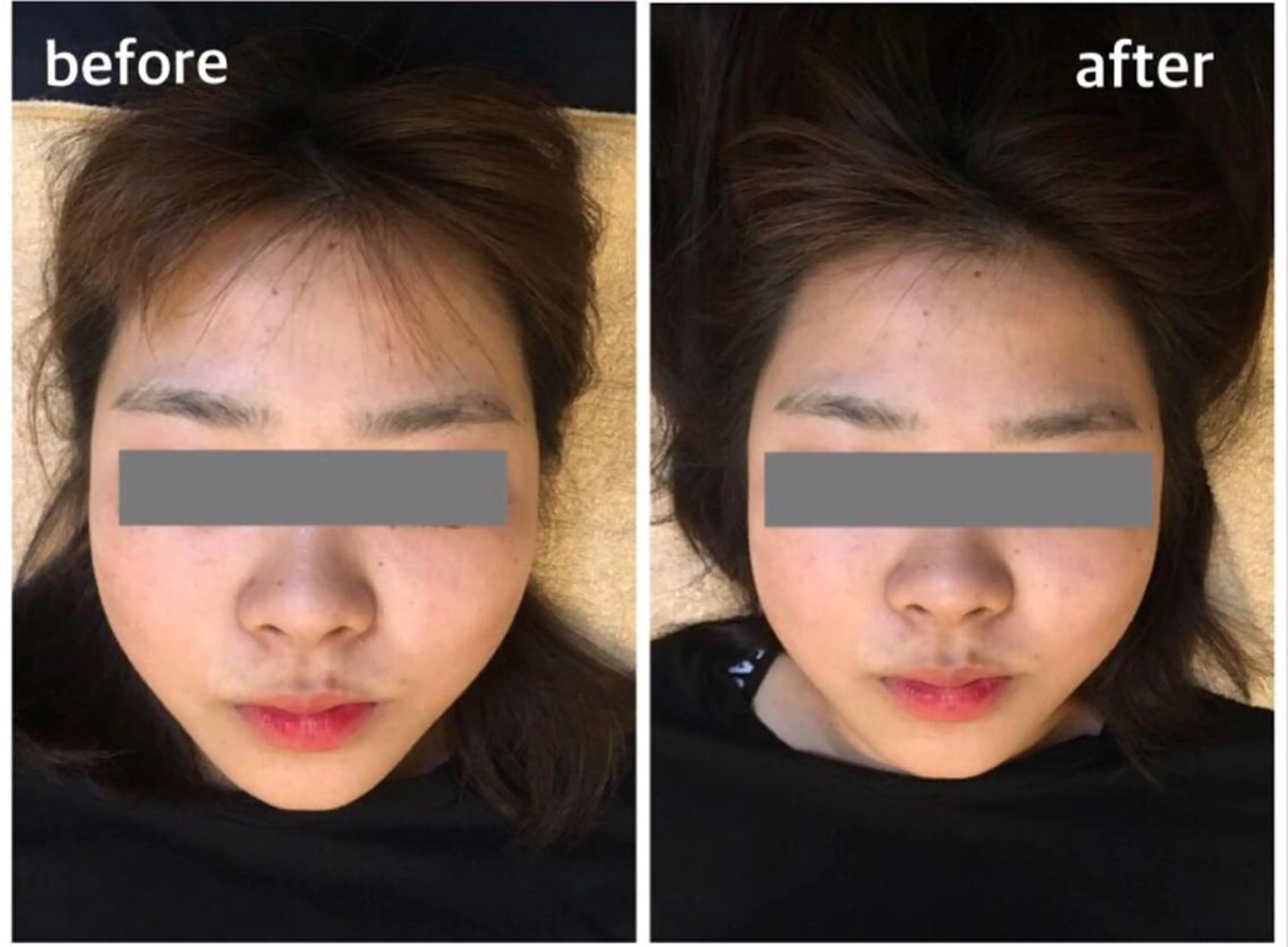 エステ リラク 佐々木 唯のエステ・リラクイメージ