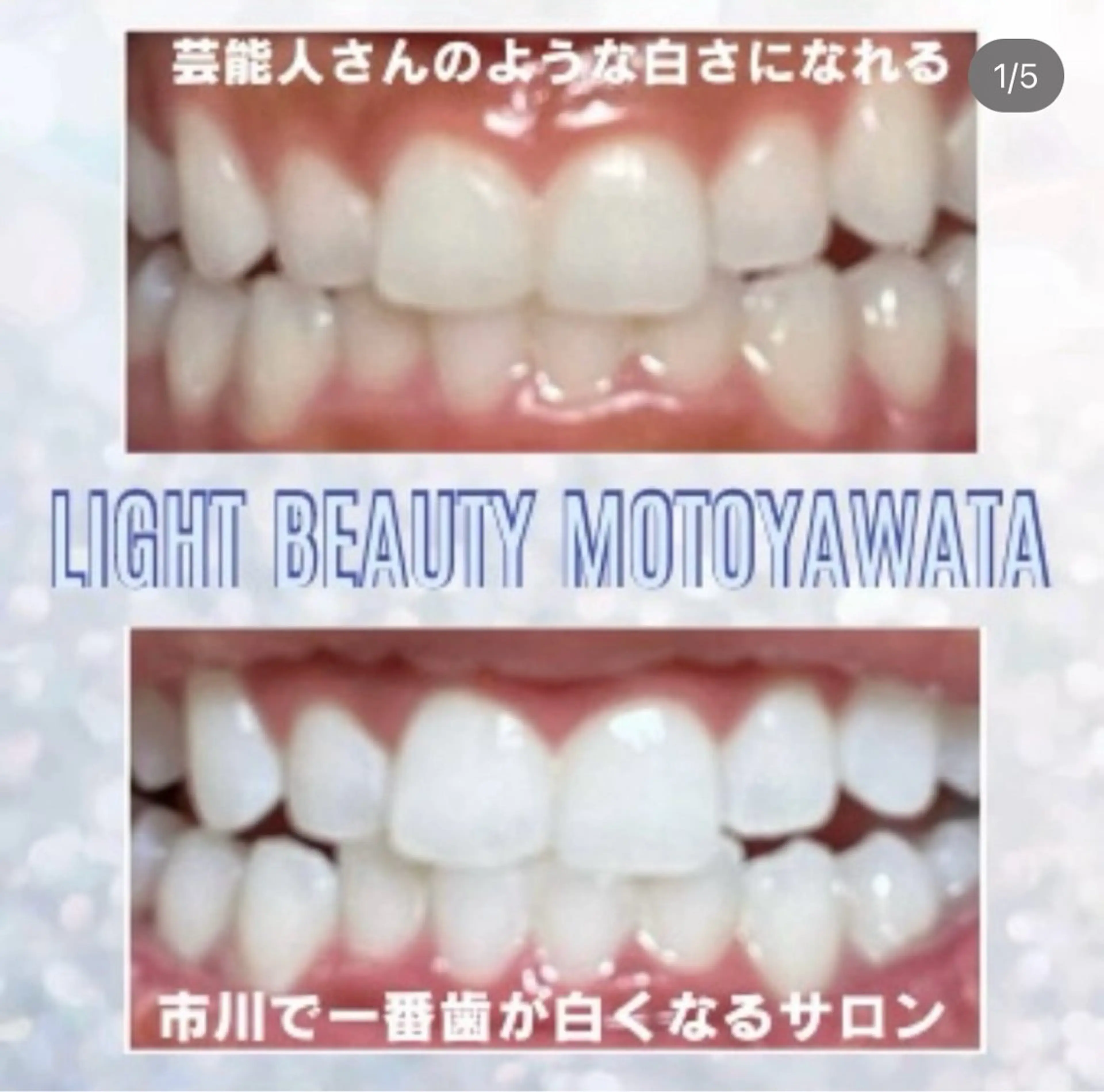 【平日限定】🦷通常お試し30分2,970円→2,470円の写真