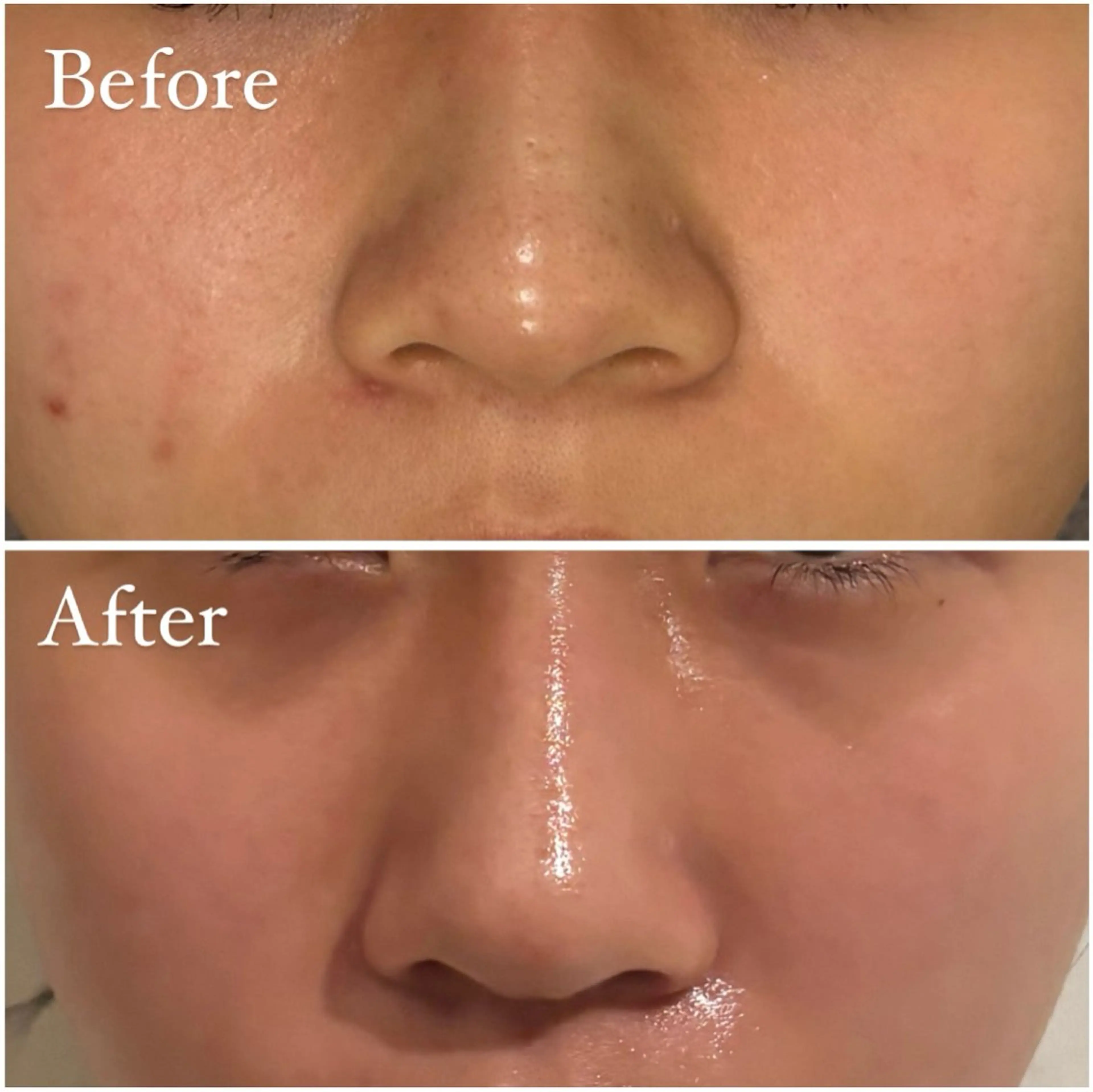 Tulipe Chihoのエステ・リラクイメージ