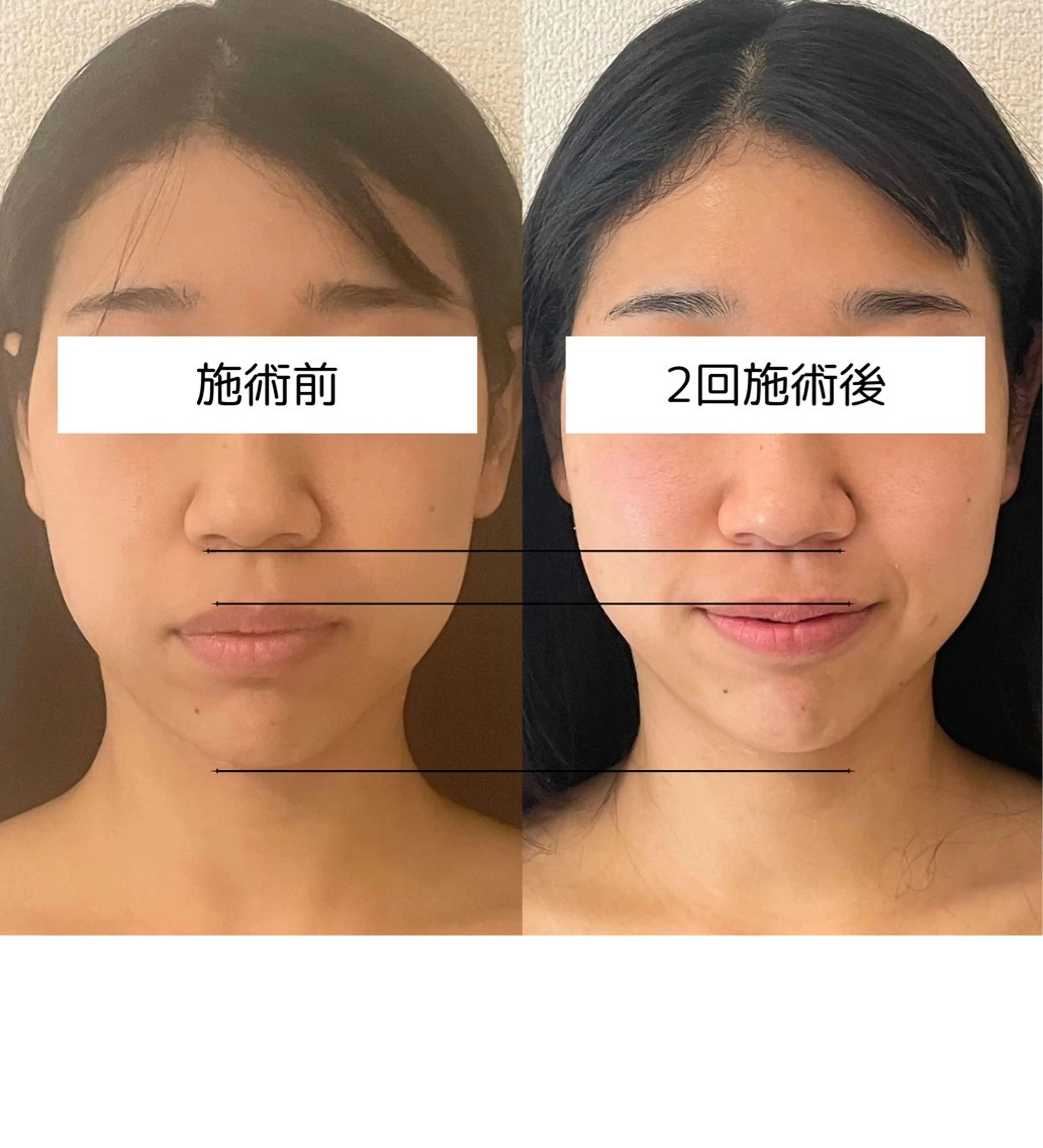 エステ 【小顔痩身専門看護師 サロンSONA】のエステ・リラクイメージ