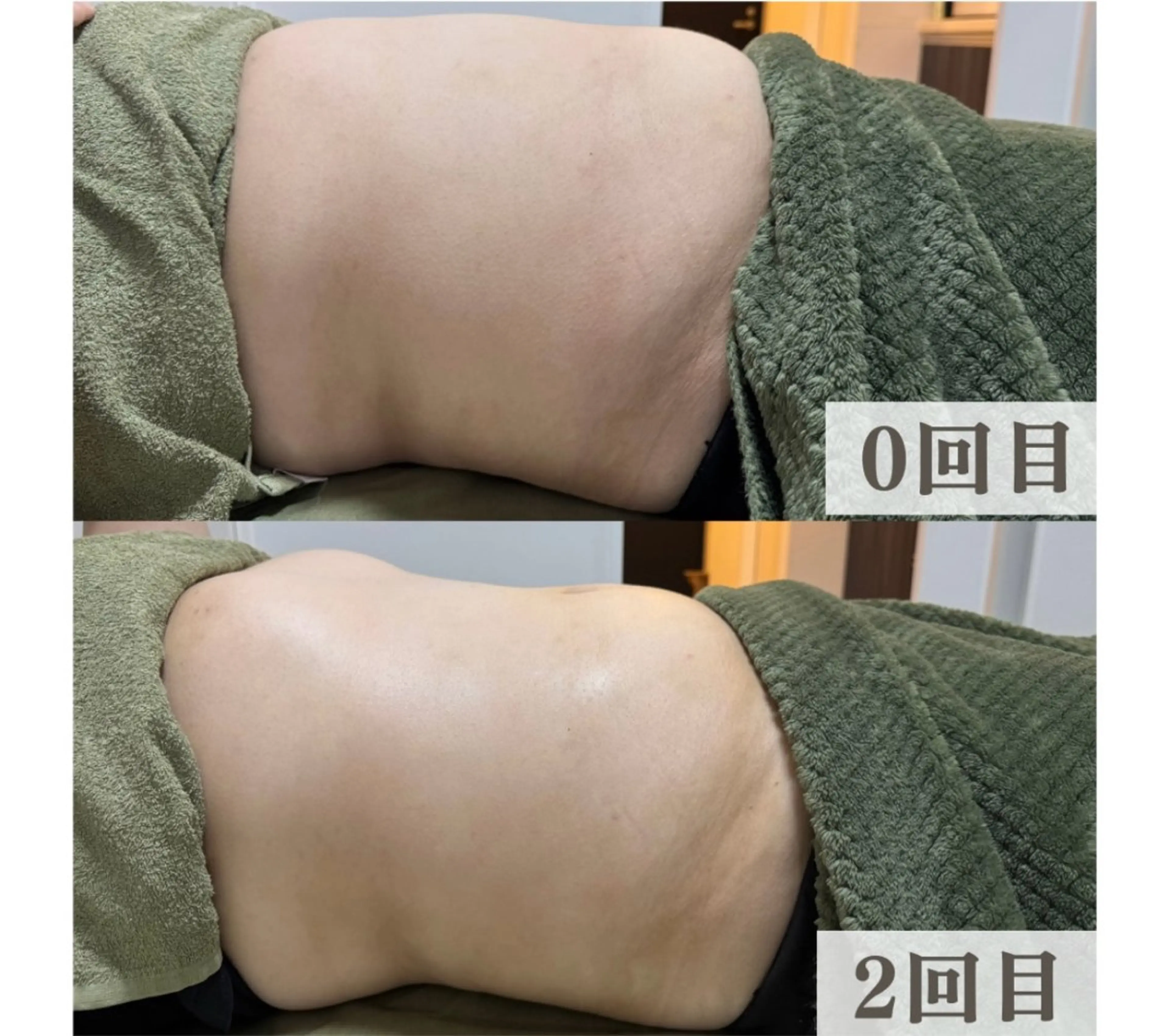 こりとり＆小顔 コルギ　専門店のエステ・リラクイメージ