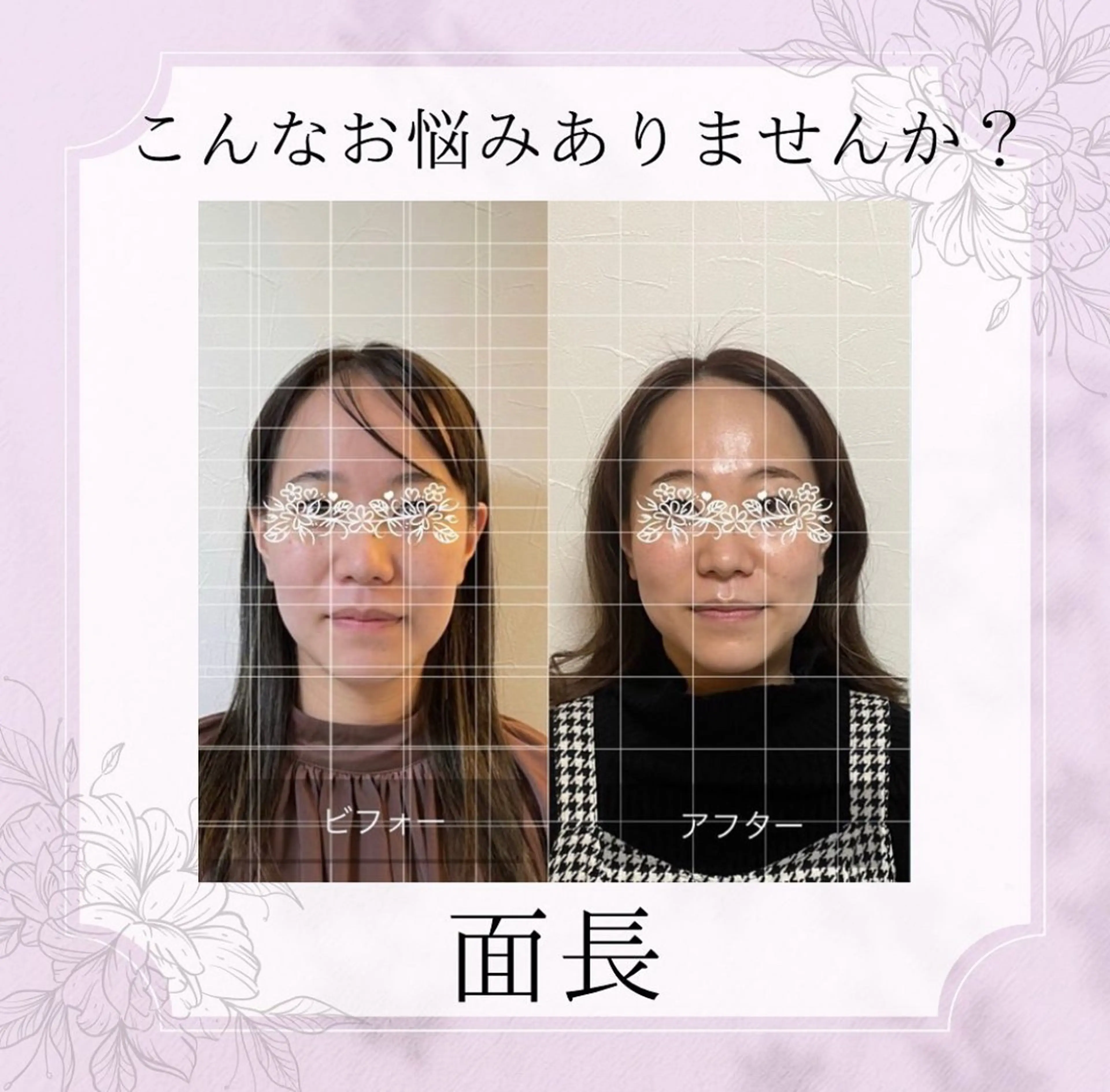 PARAFUSE. 新潟のエステ・リラクイメージ